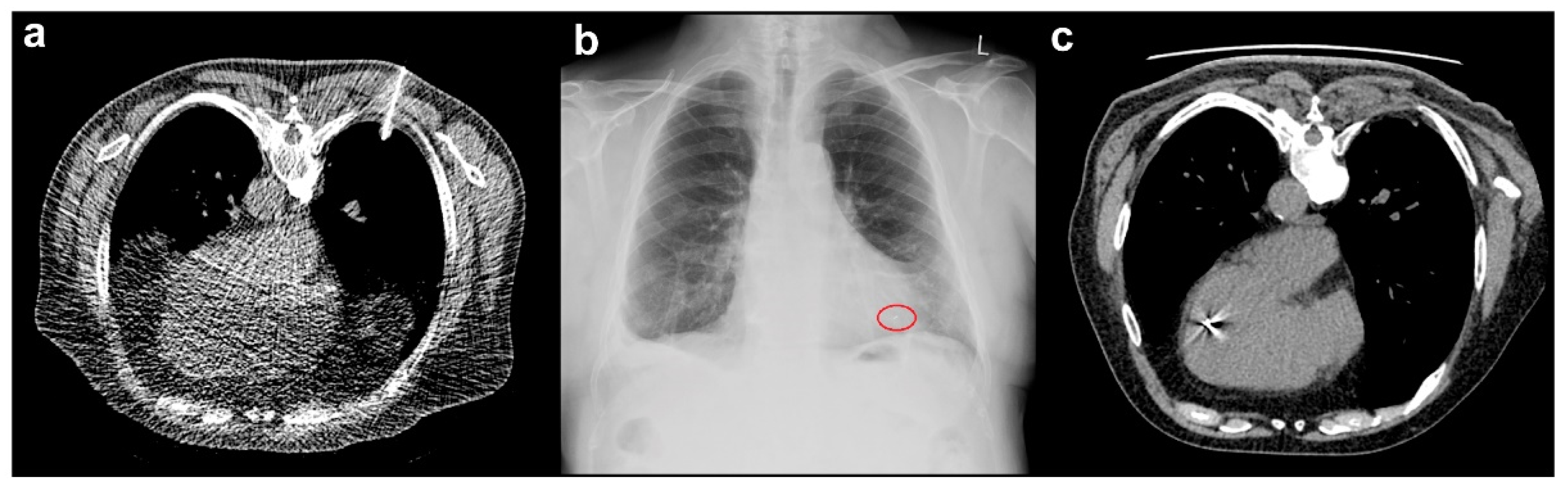 Cancers 13 04838 g002