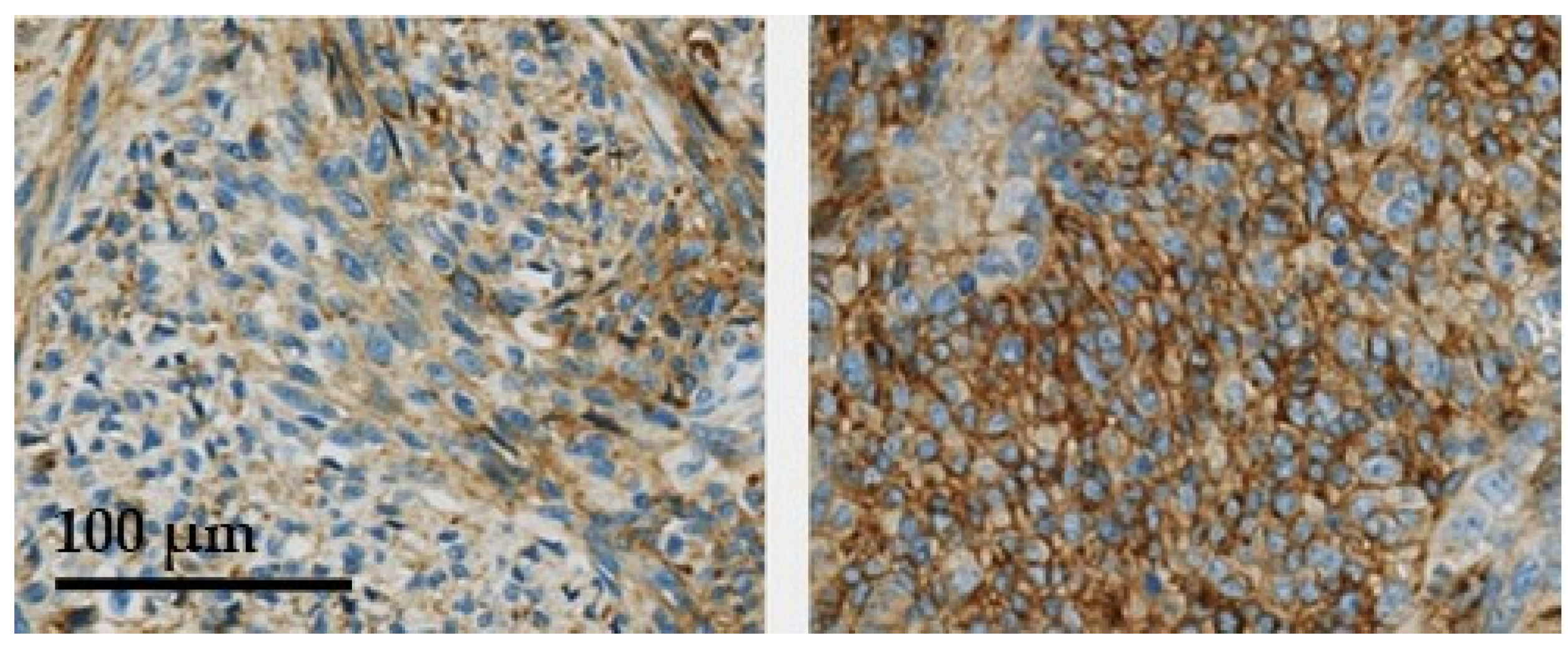 Cancers 13 04841 g002