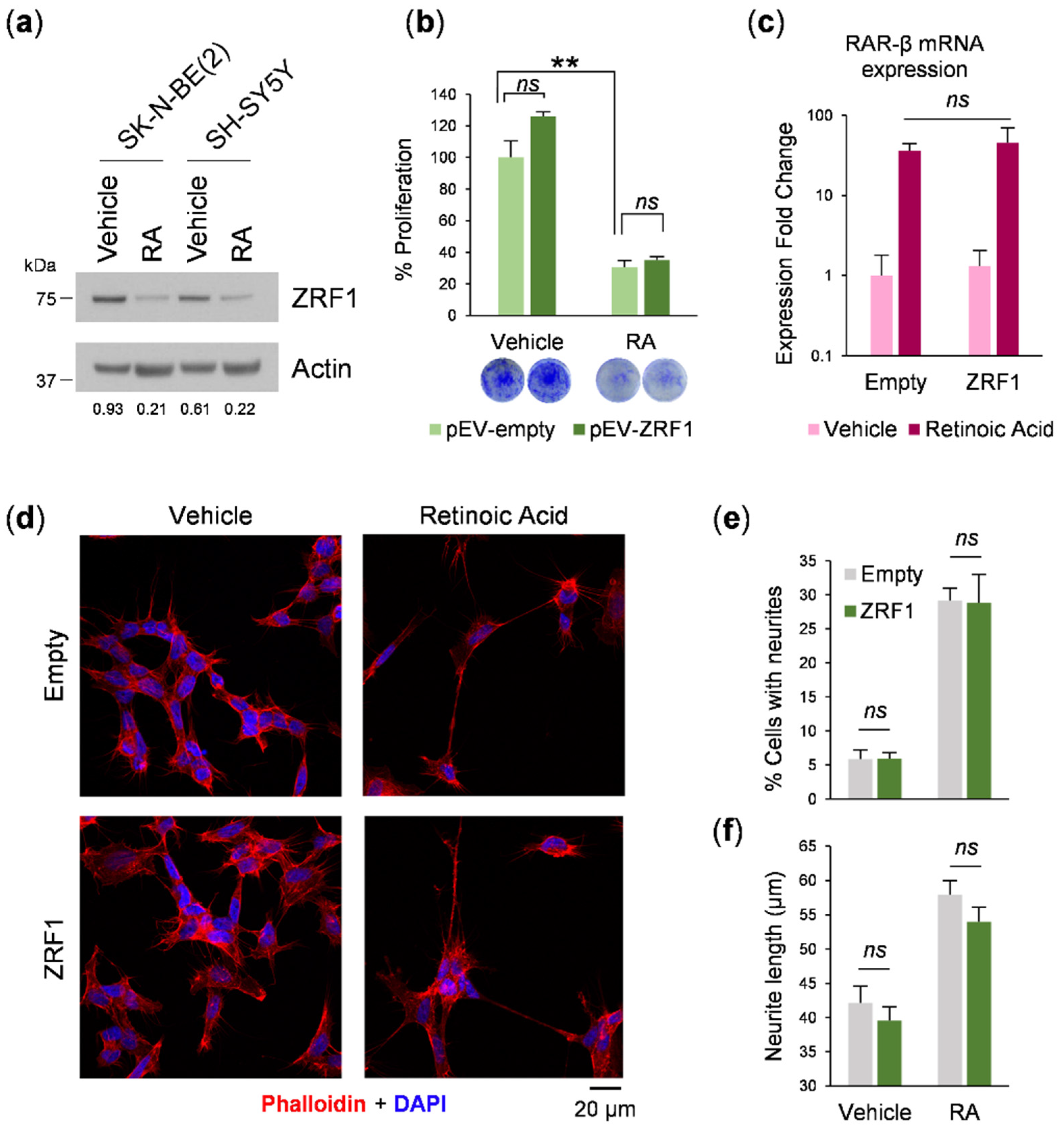 Cancers 13 04845 g004