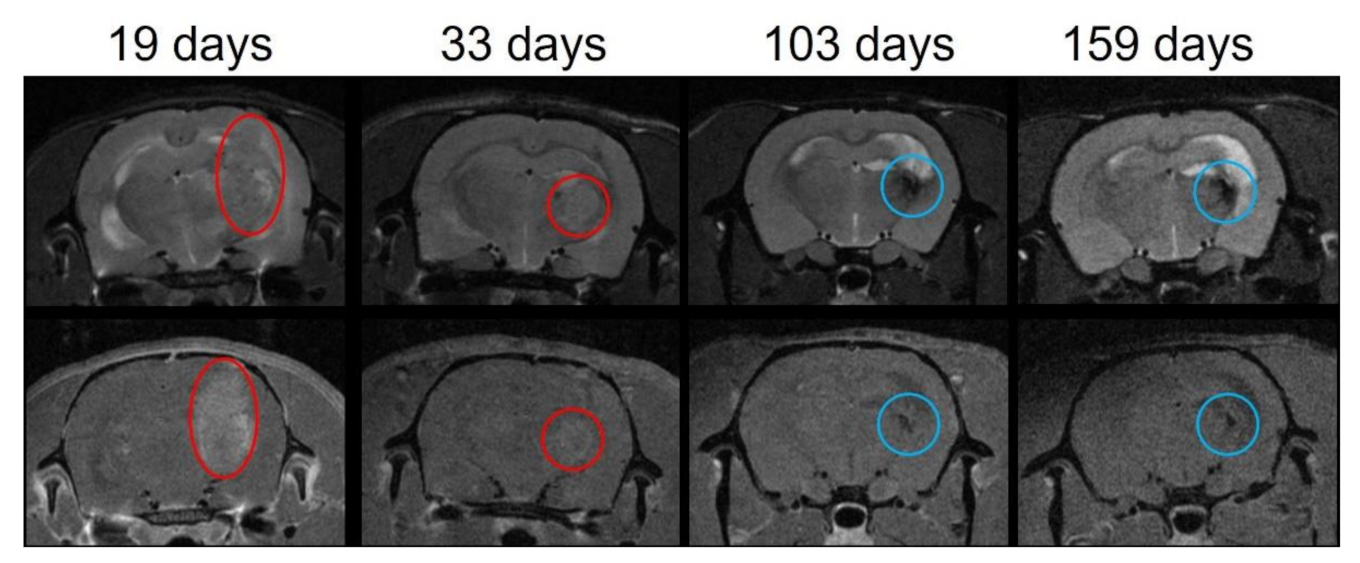 Cancers 13 04865 g004