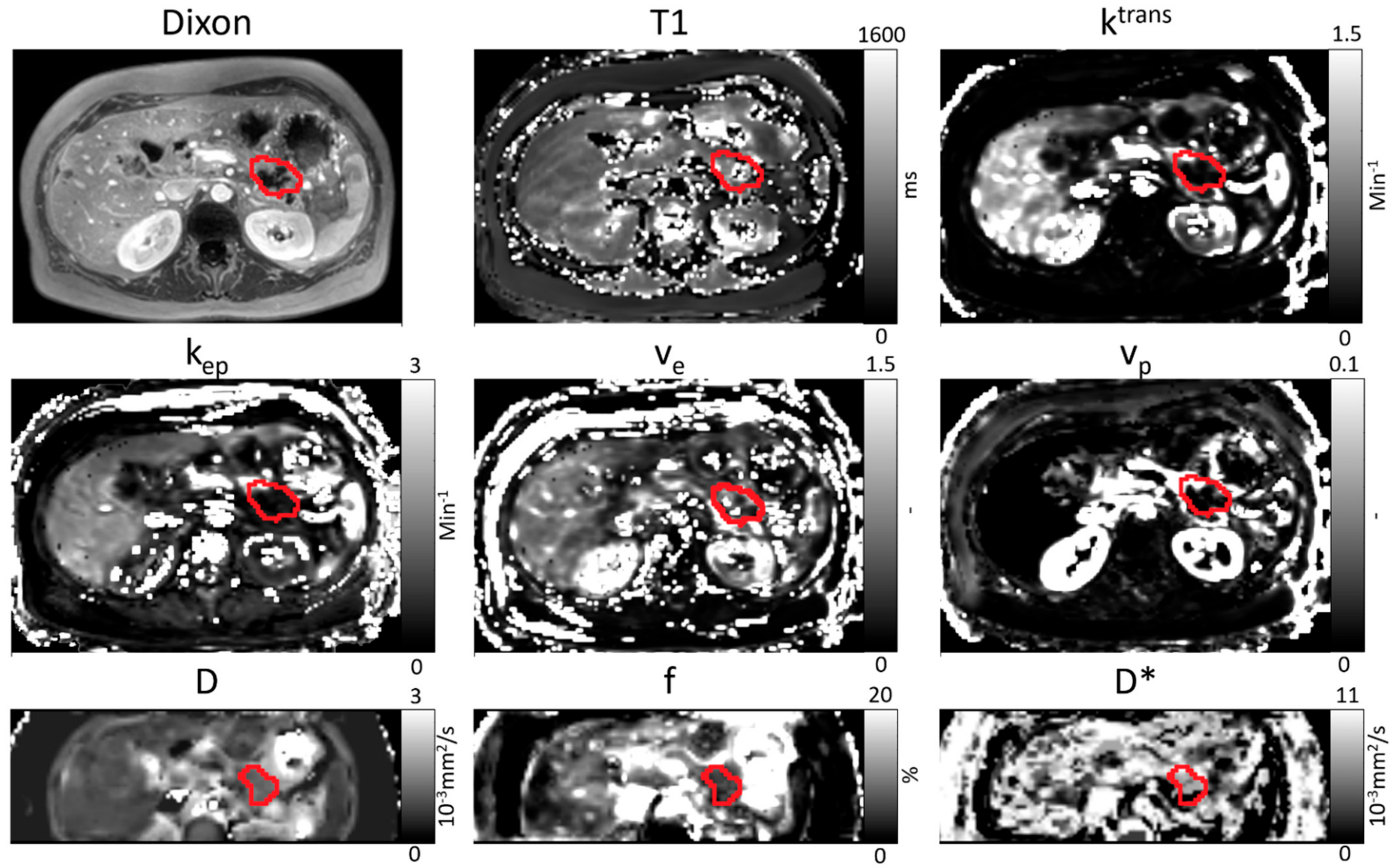 Cancers 13 04869 g003