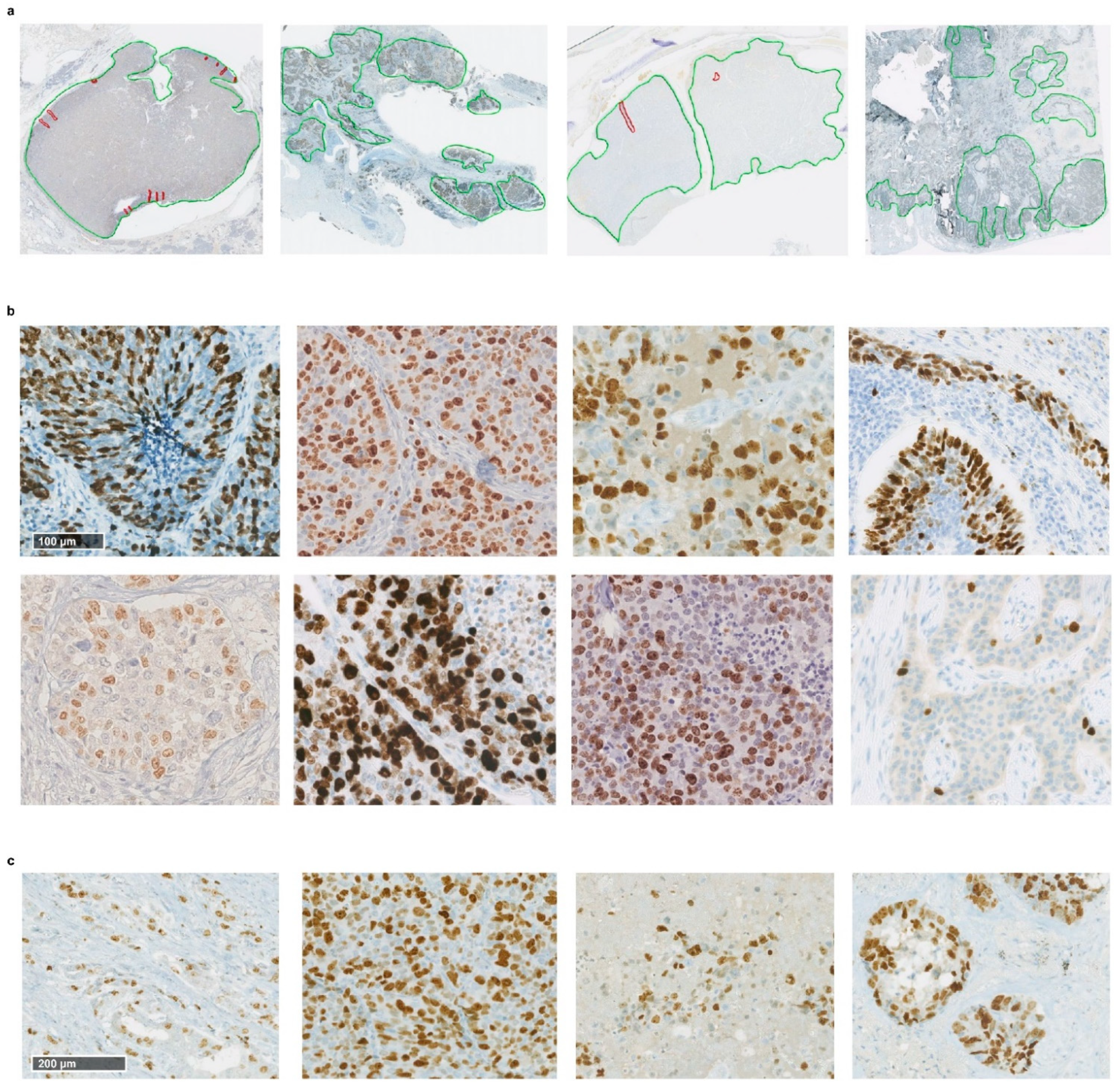 Cancers 13 04875 g006