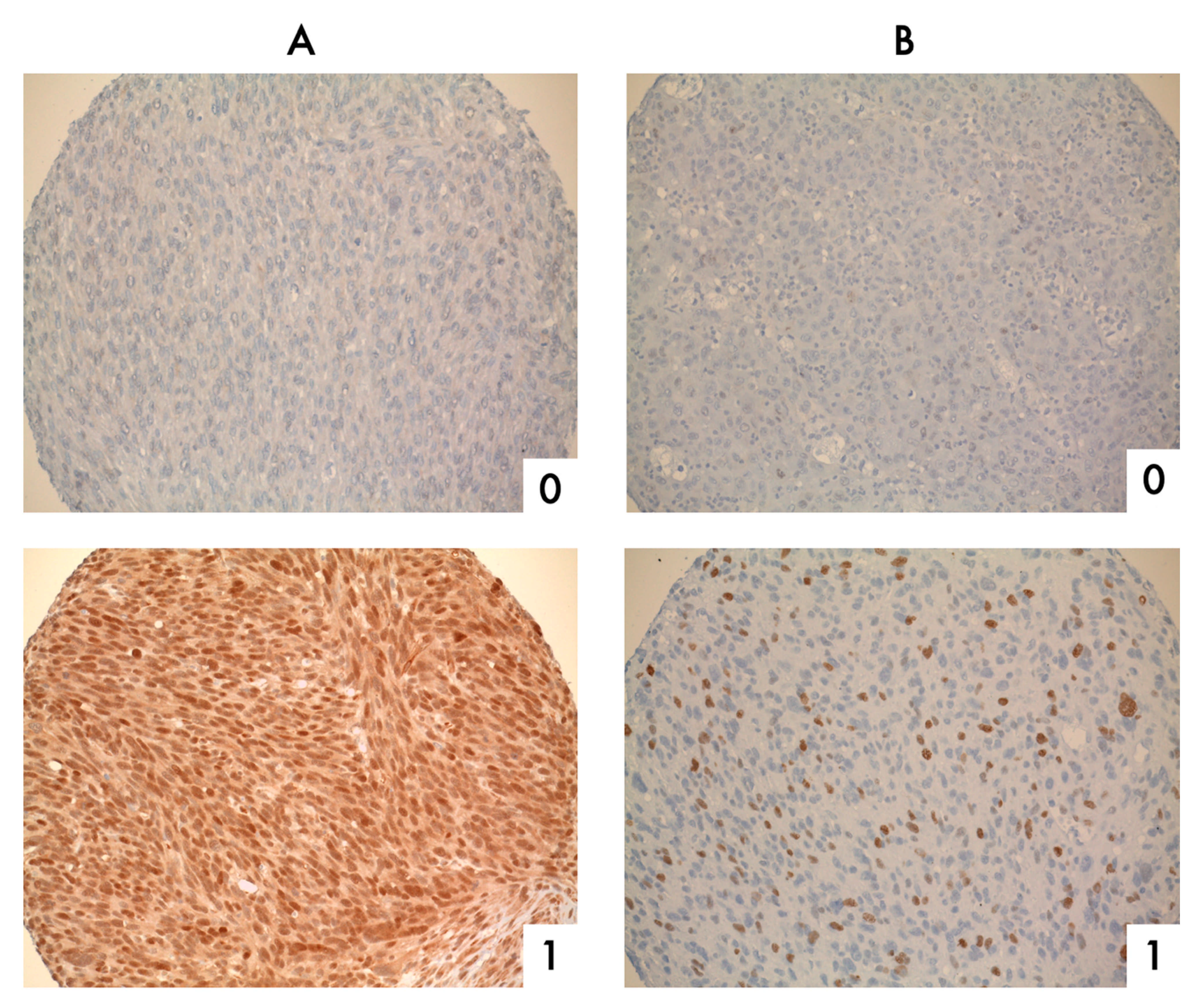 Cancers 13 04877 g001