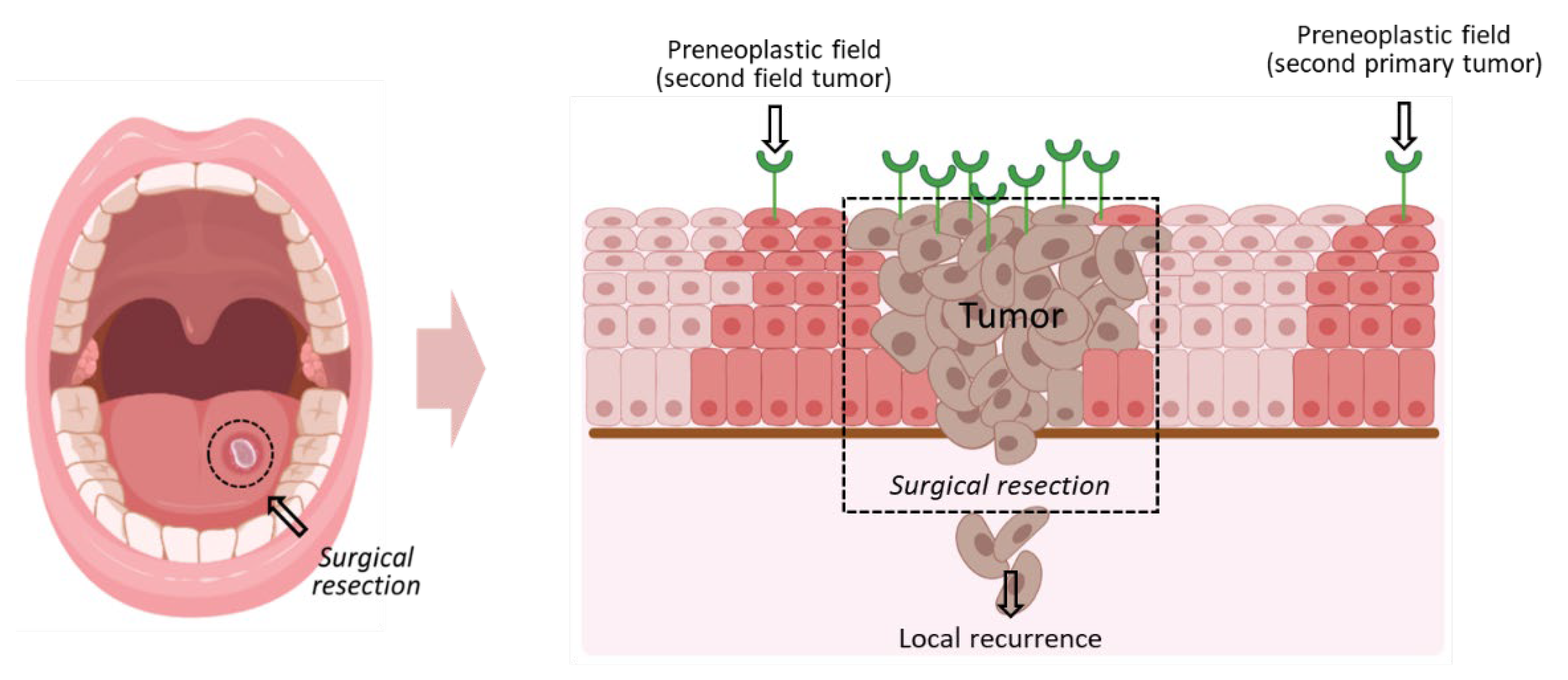 Cancers 13 04920 g001