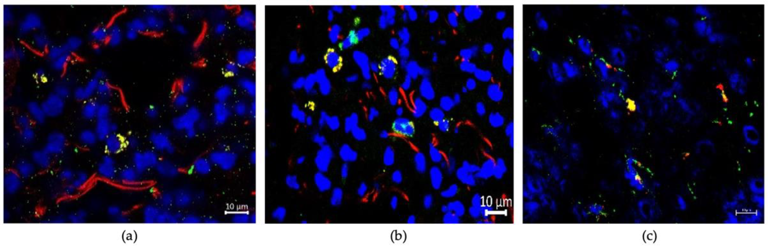 Cancers 13 04937 g009