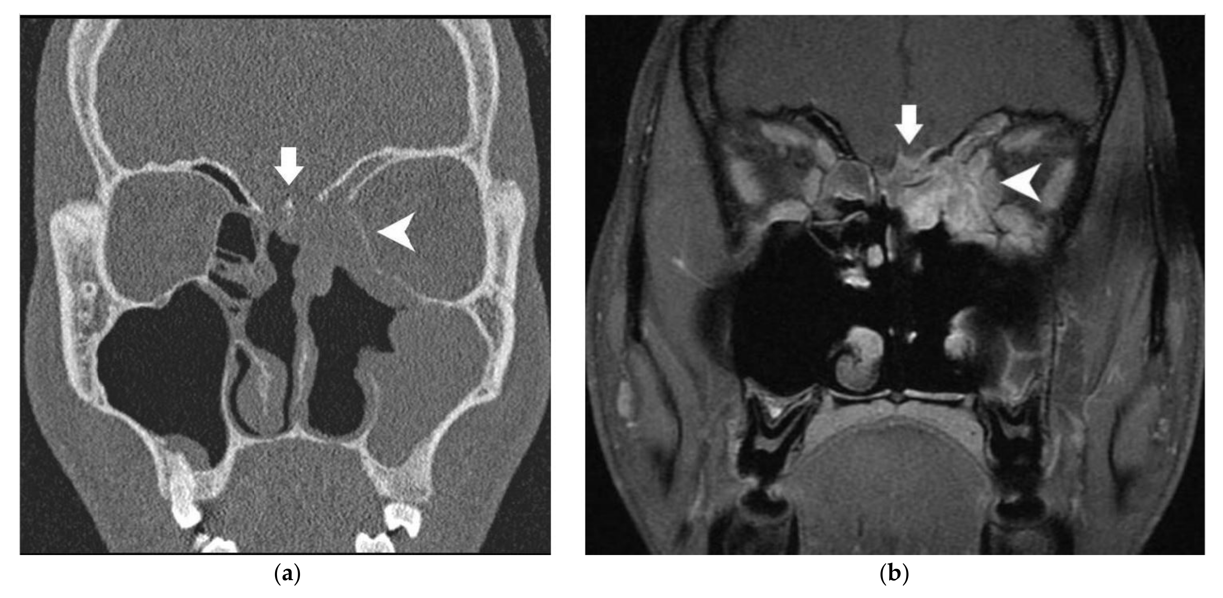 Cancers 13 04963 g001