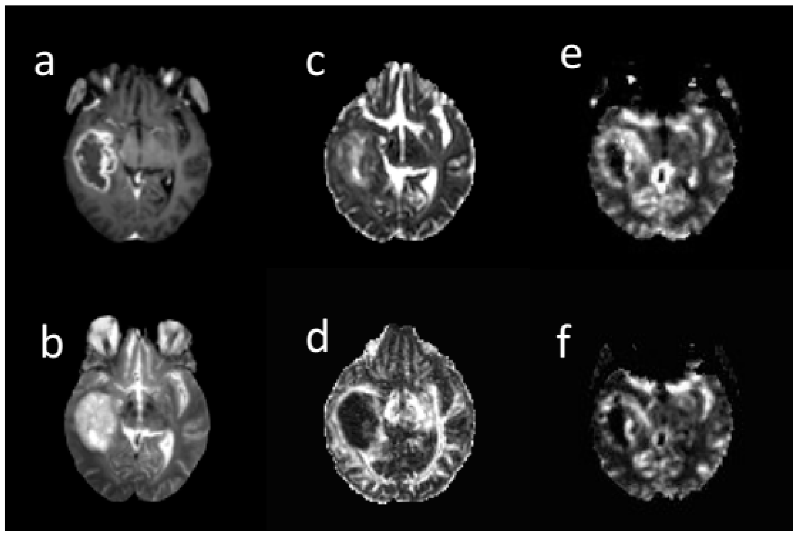 Cancers 13 04976 g002