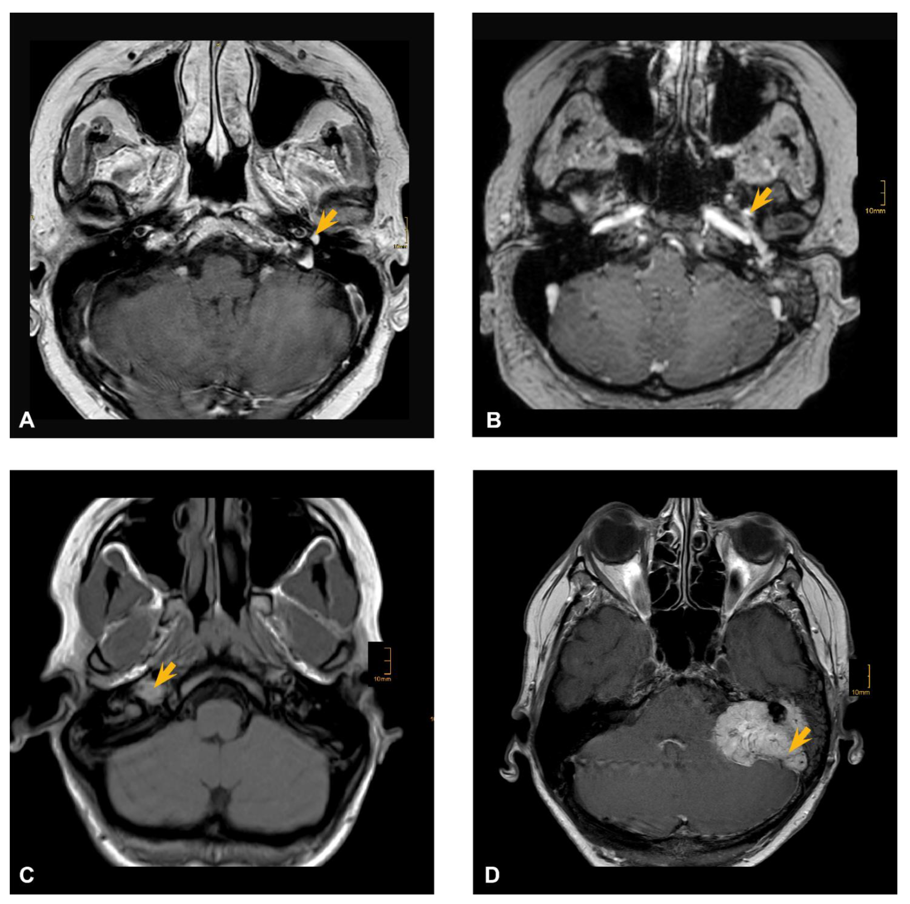 Cancers 13 05083 g001