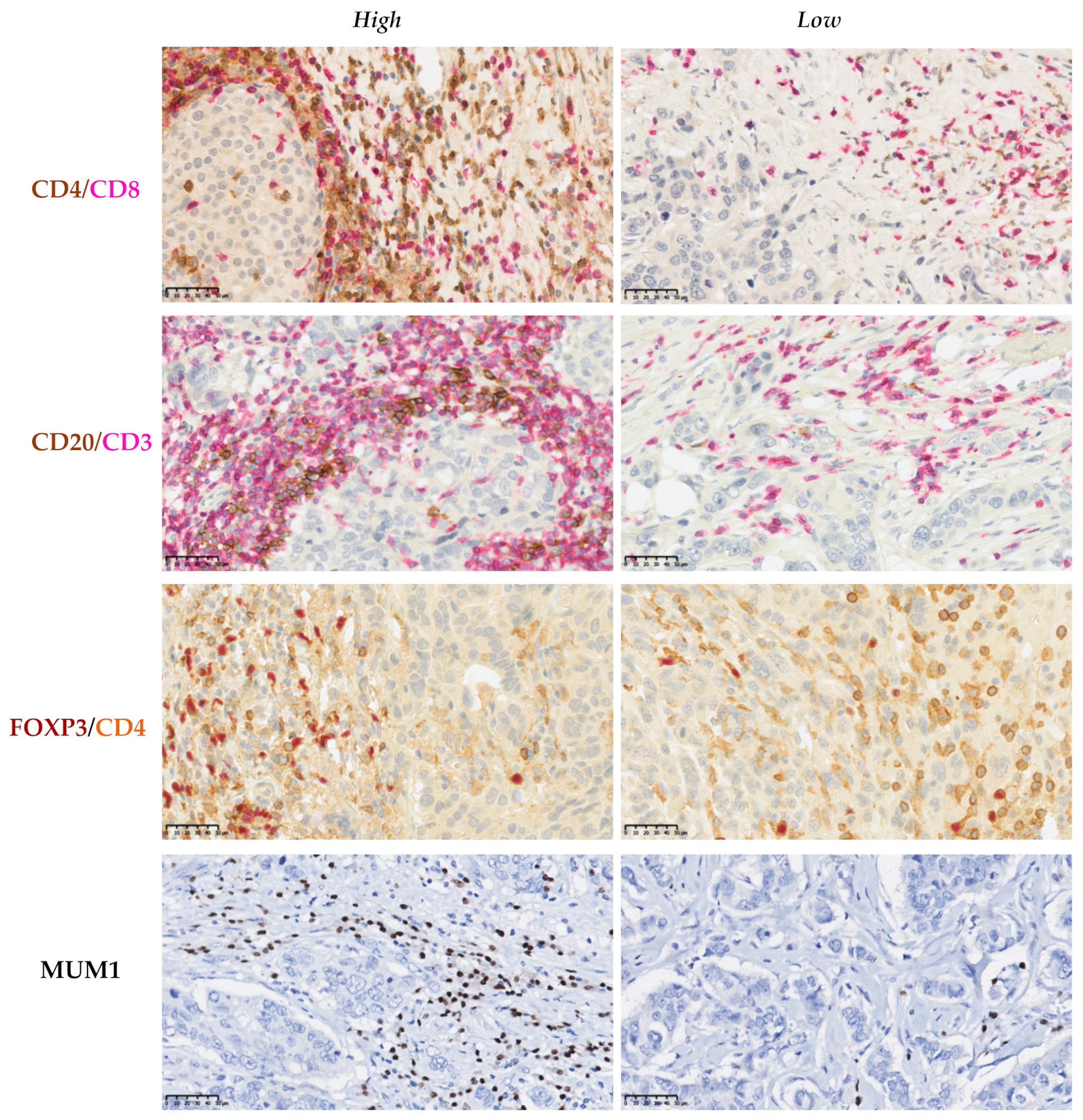 Cancers 13 05099 g004