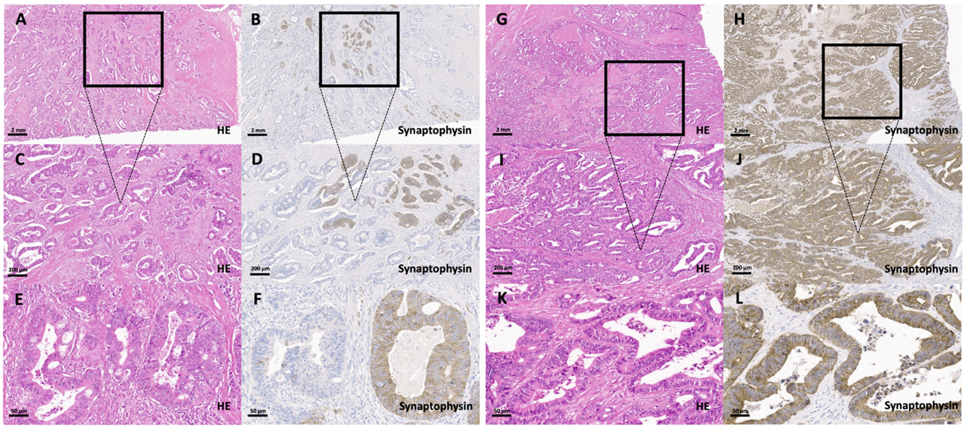 Cancers 13 05111 g001