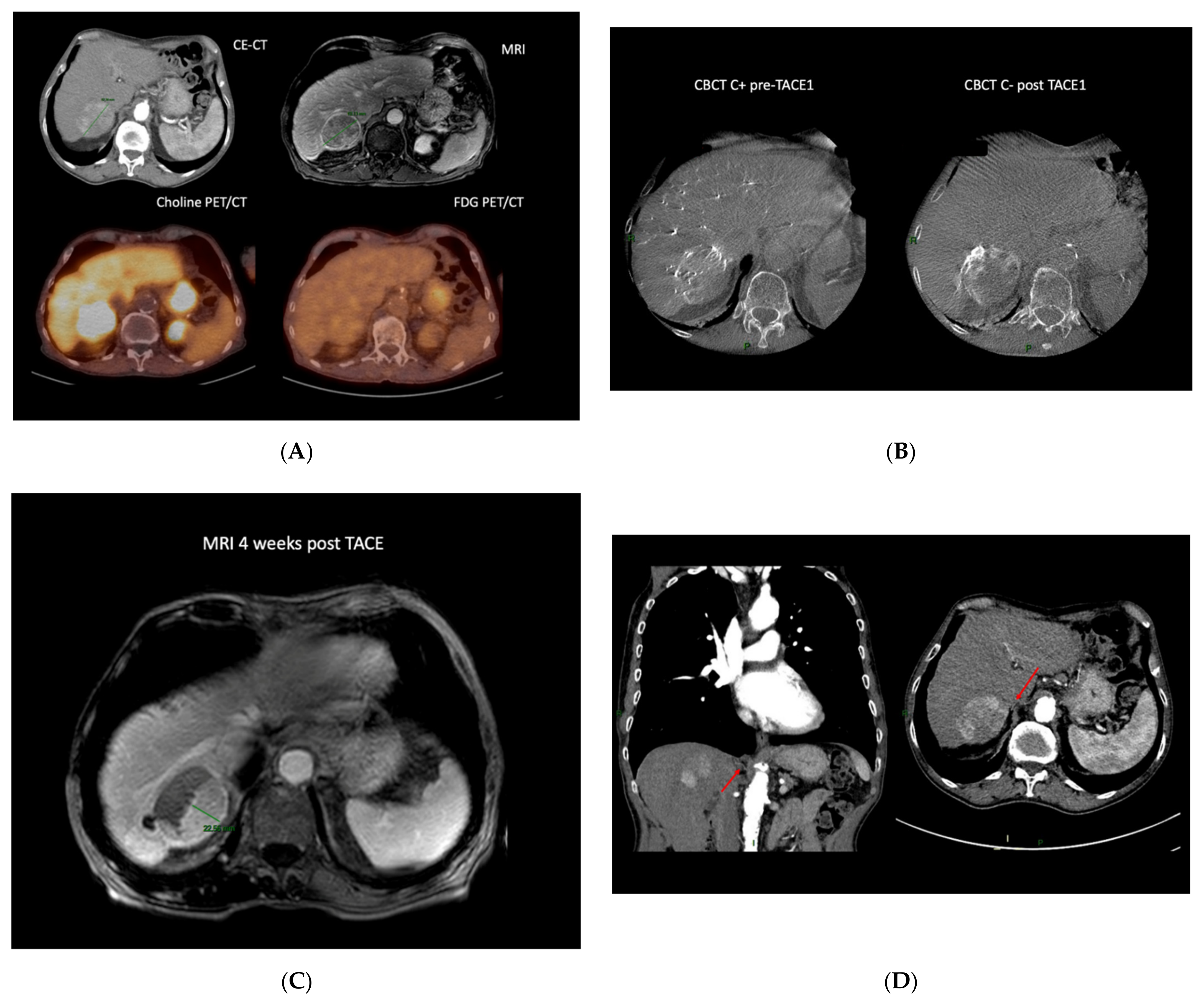 Cancers 13 05129 g001