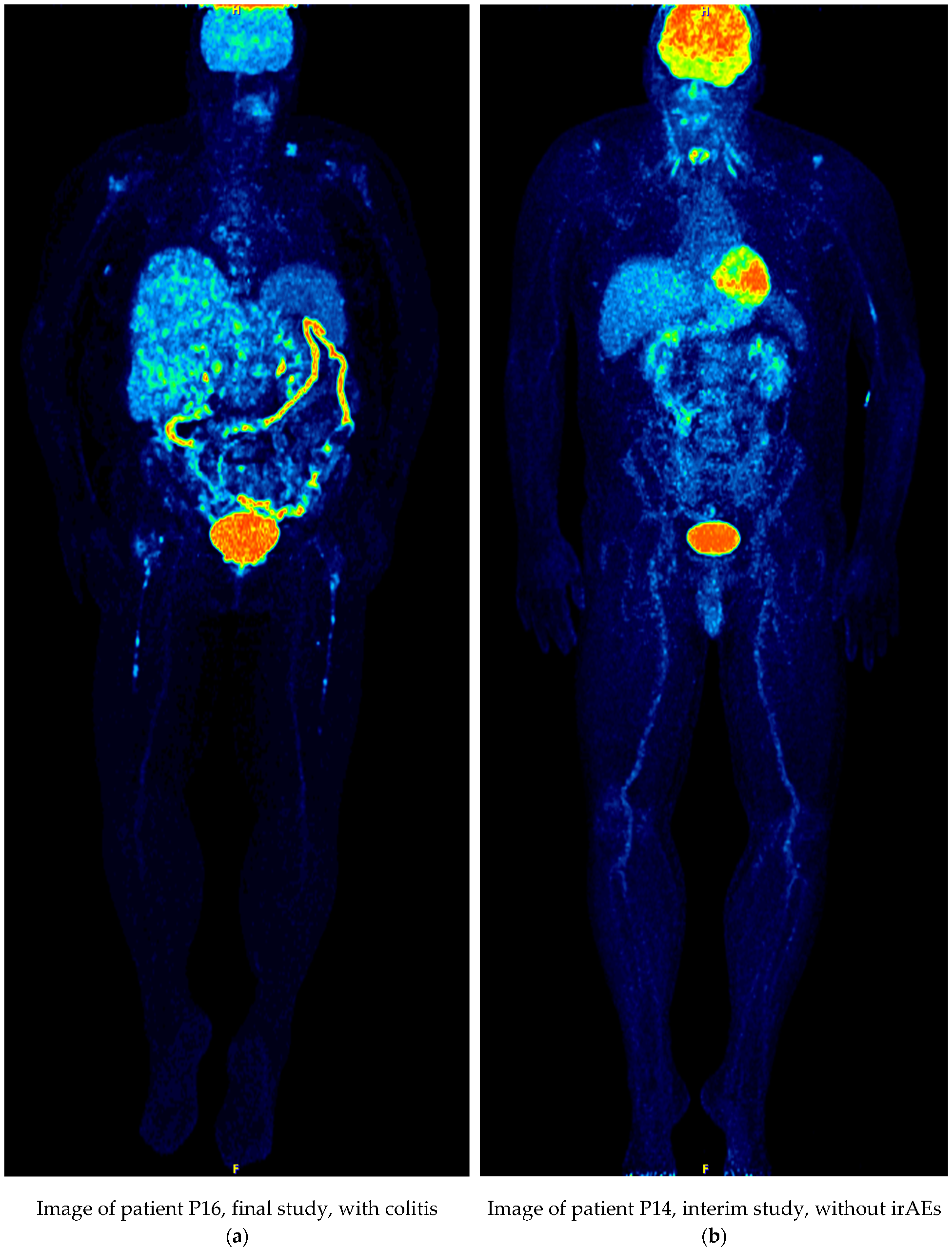 Cancers 13 05170 g003