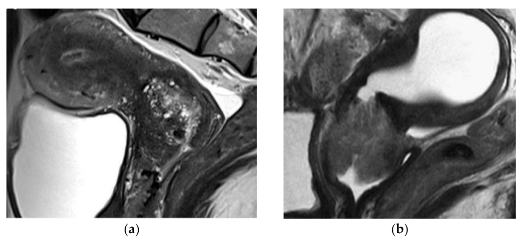 Cancers 13 05177 g001