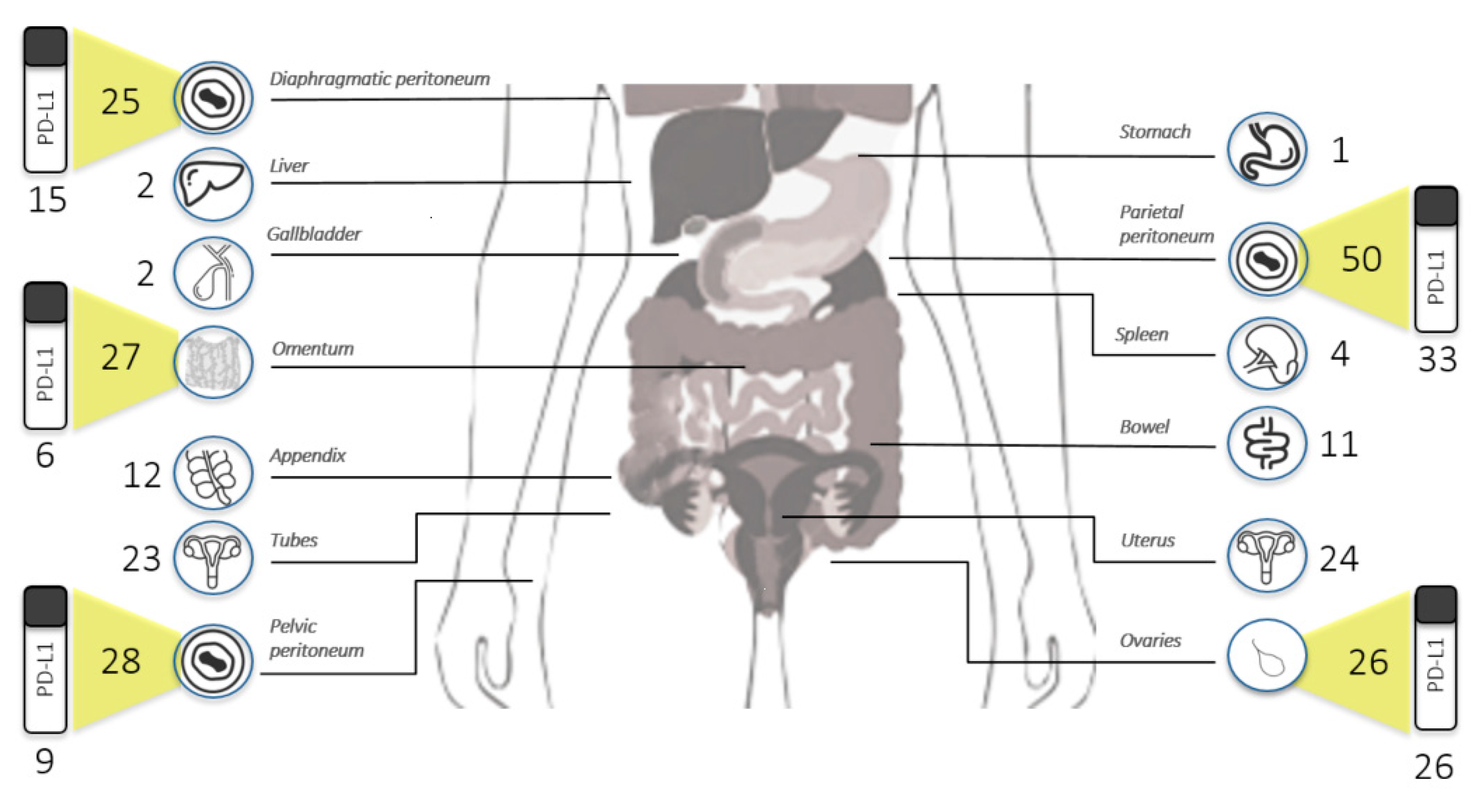 Cancers 13 05200 g001