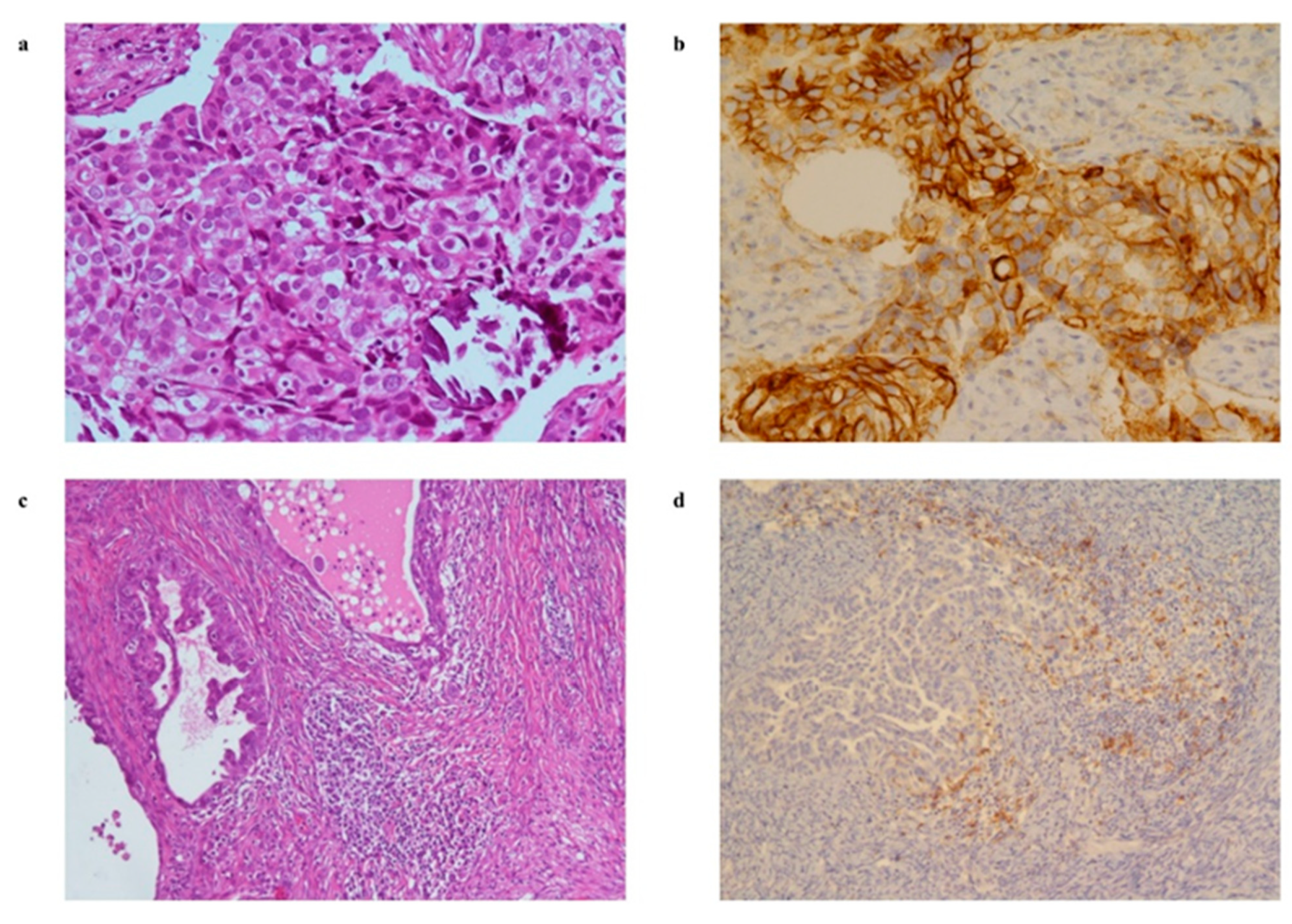 Cancers 13 05200 g003