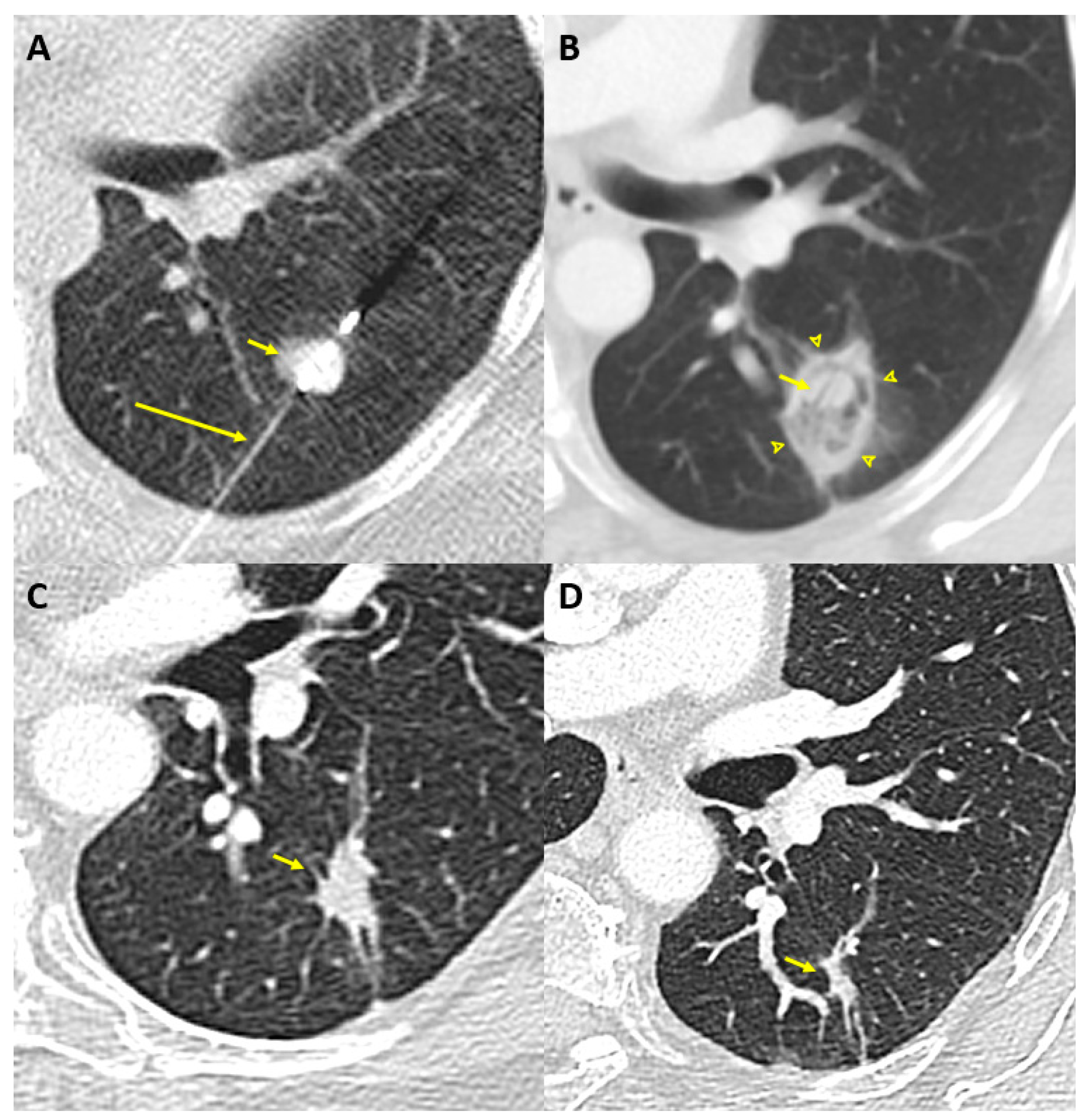 Cancers 13 05202 g001