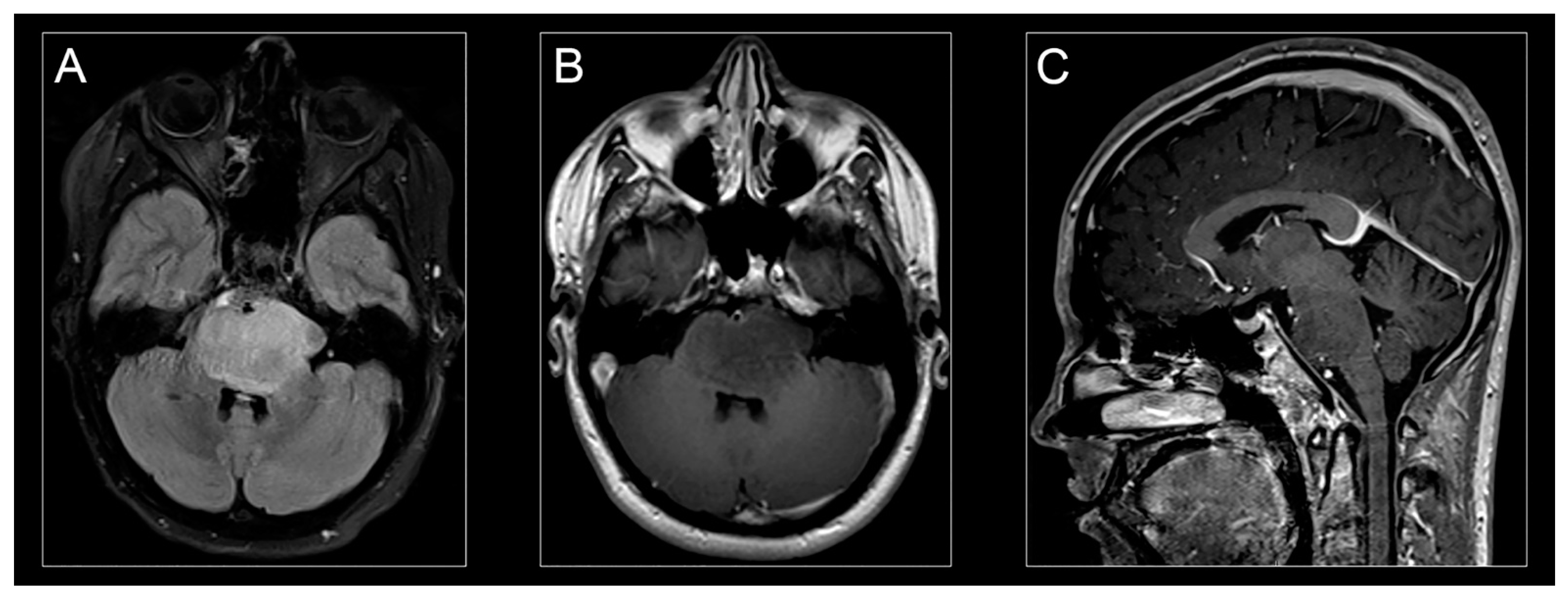 Cancers 13 05280 g002