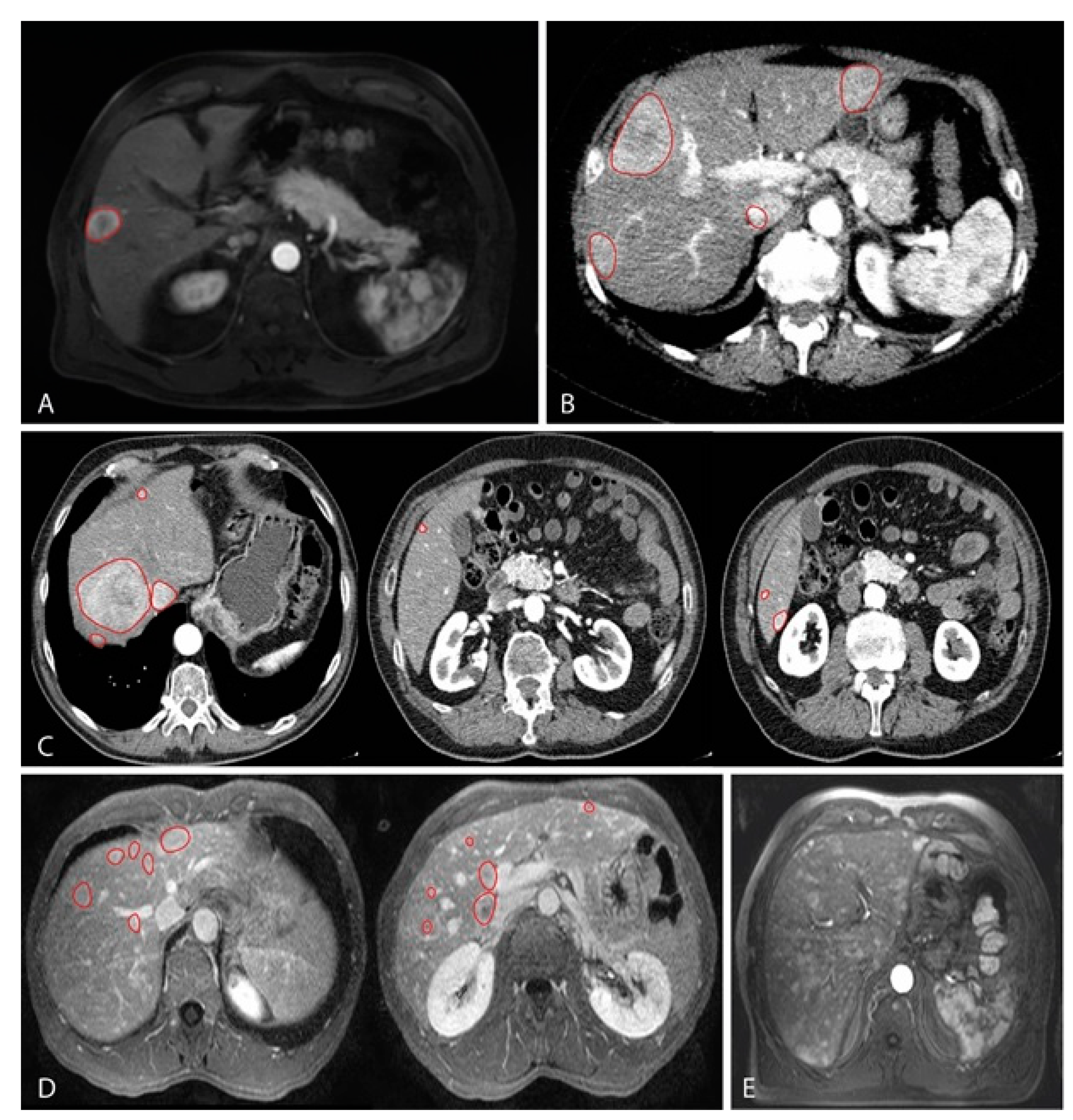 Cancers 13 05316 g001