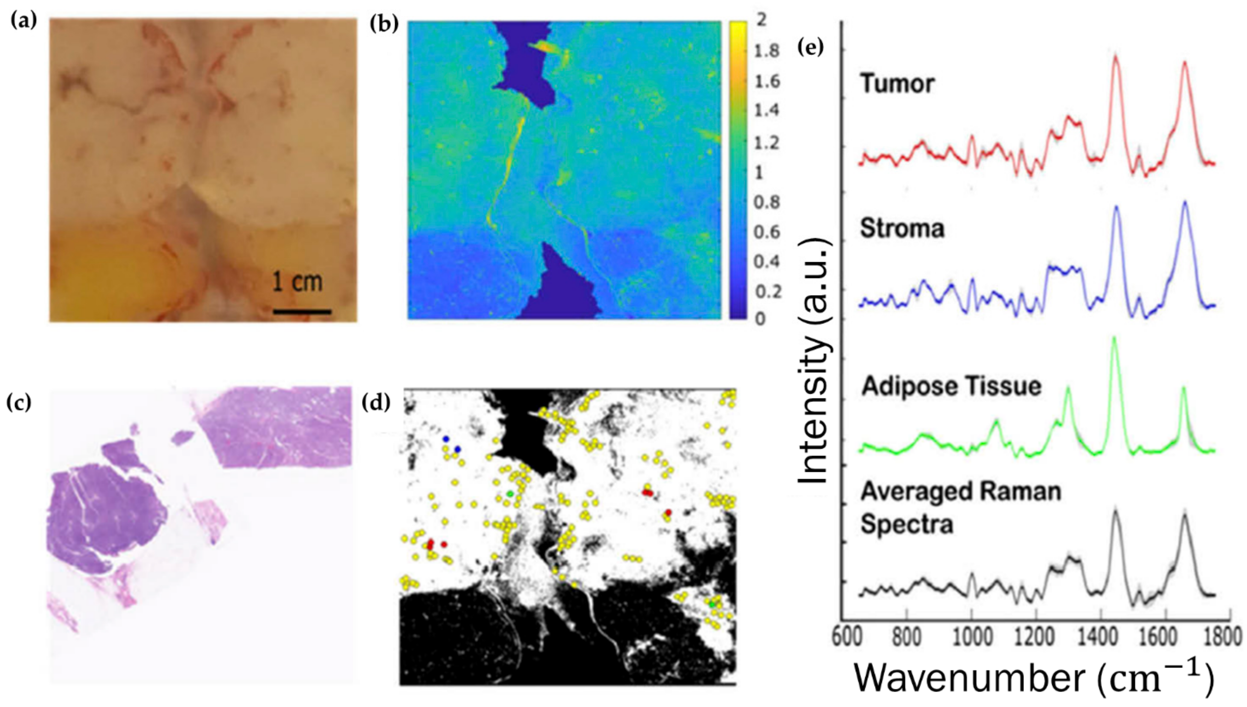 Cancers 13 05336 g005
