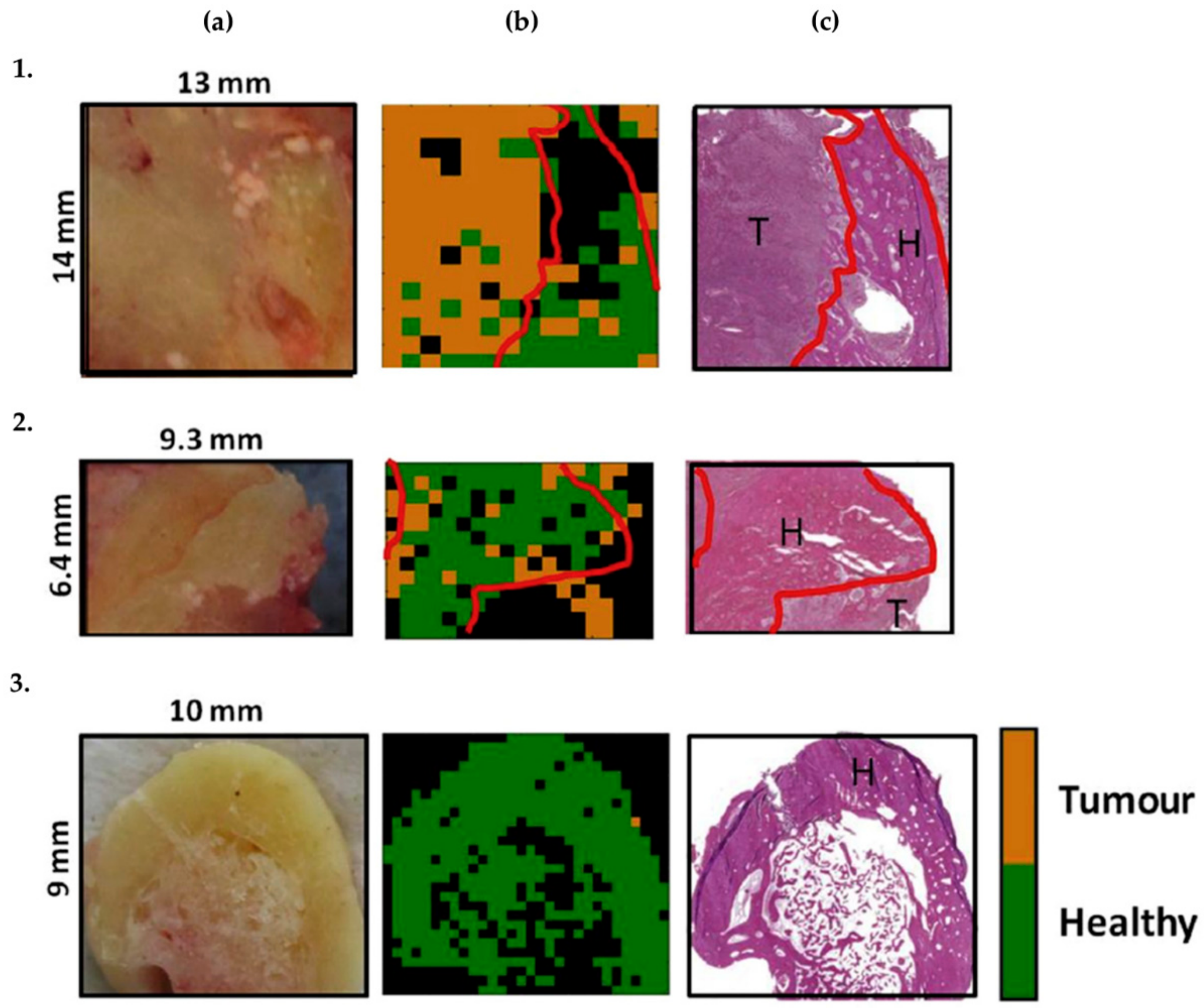 Cancers 13 05336 g007