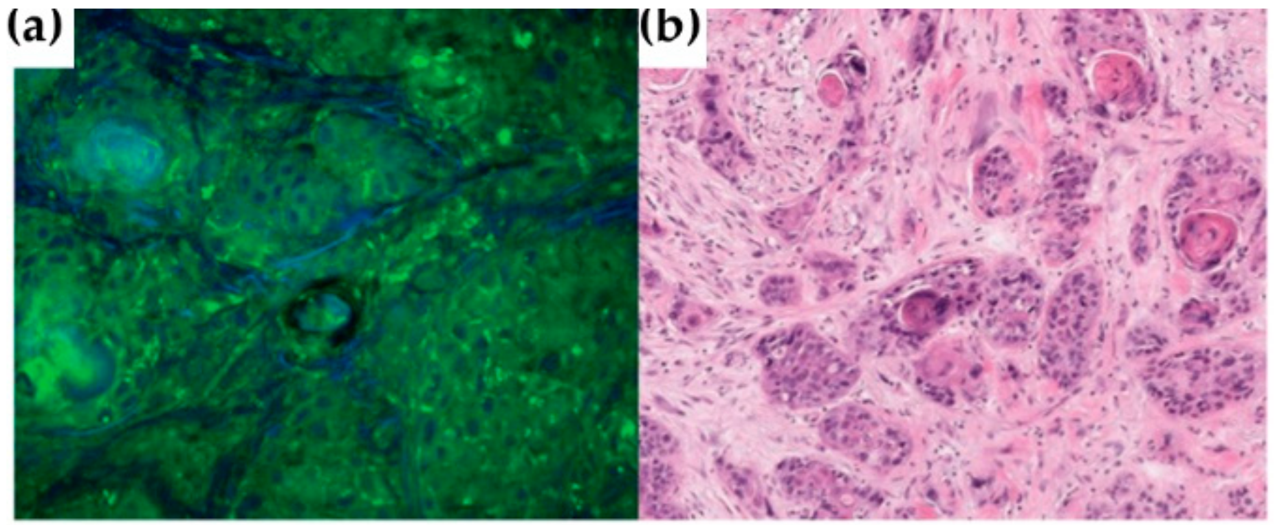 Cancers 13 05336 g008