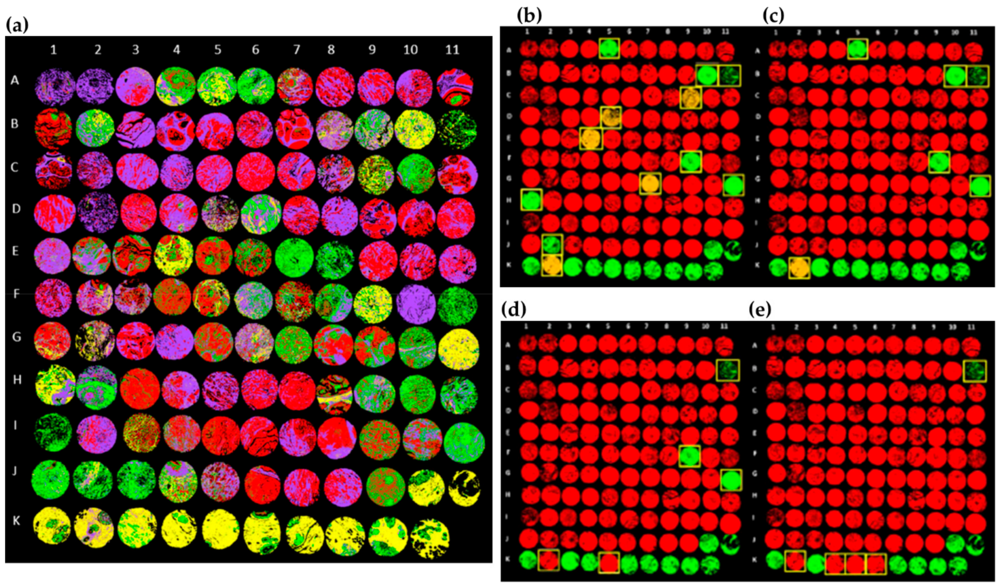 Cancers 13 05336 g011