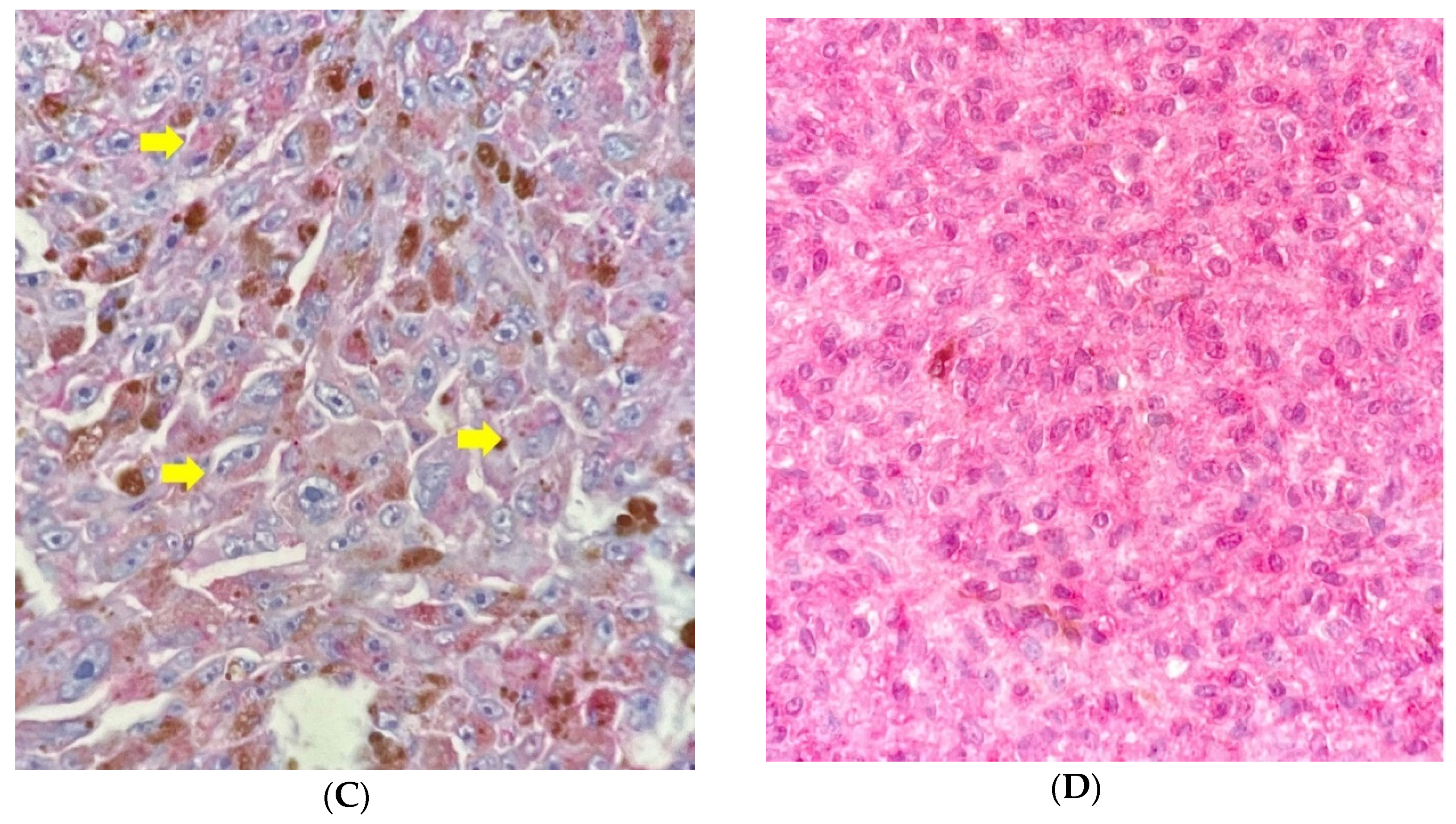 Cancers 13 05347 g003b