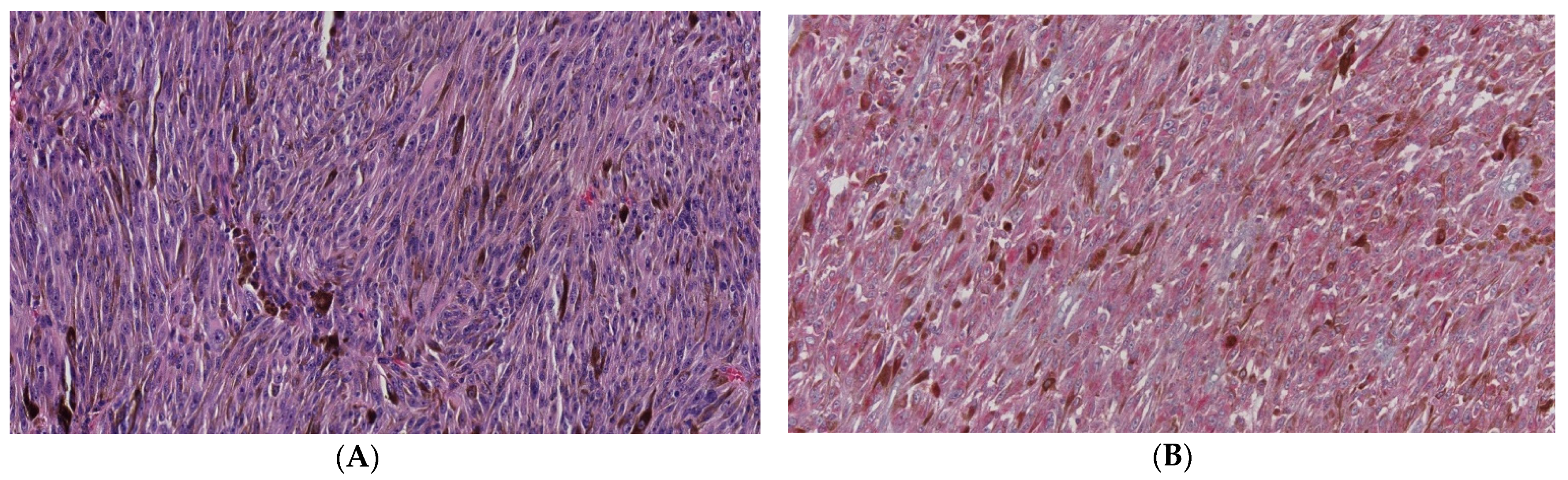 Cancers 13 05347 g004