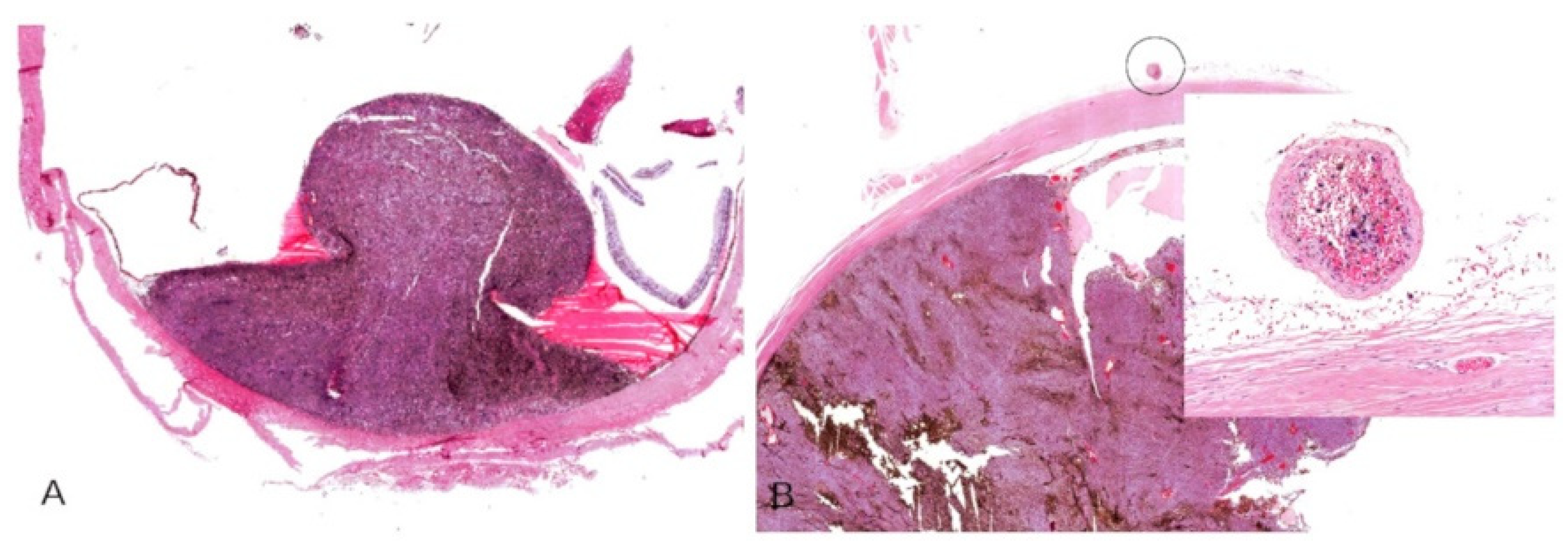 Cancers 13 05347 g005