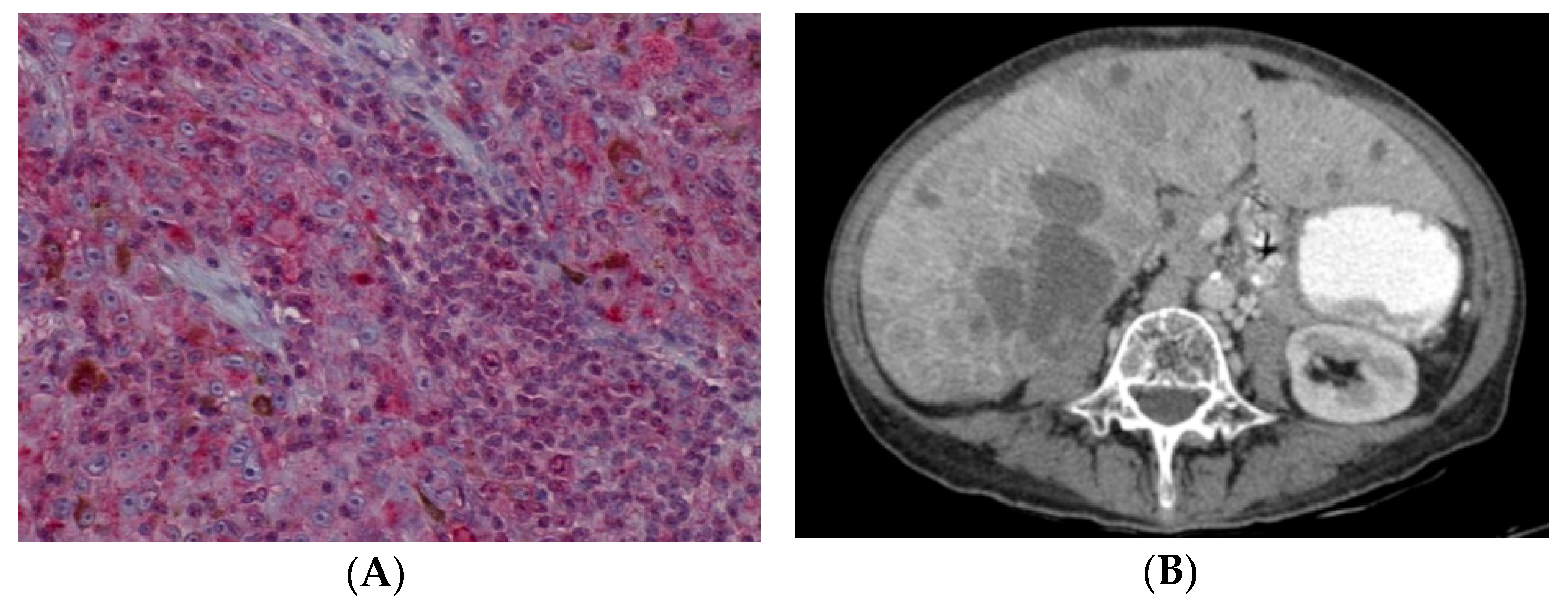 Cancers 13 05347 g007