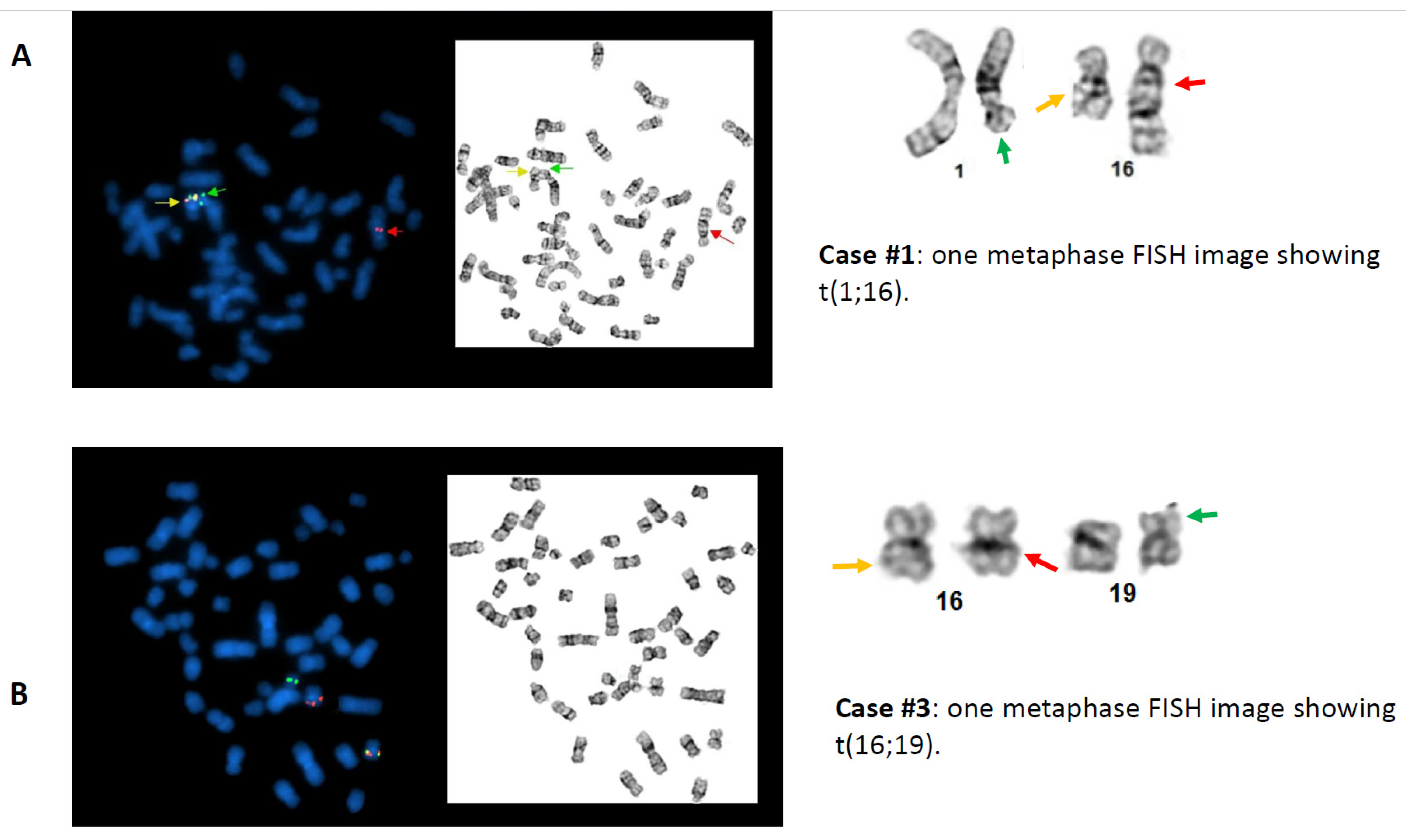 Cancers 13 05354 g002