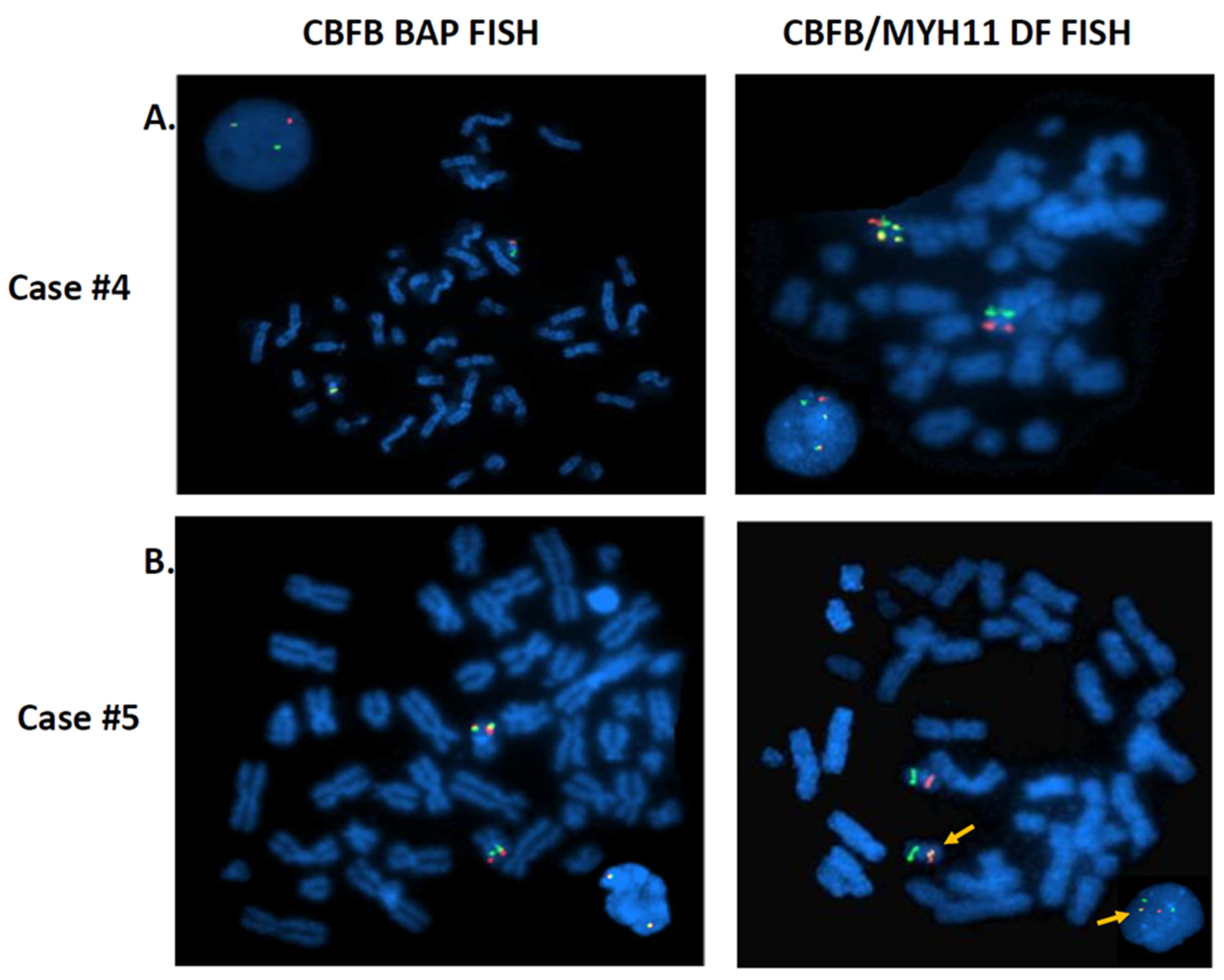 Cancers 13 05354 g003