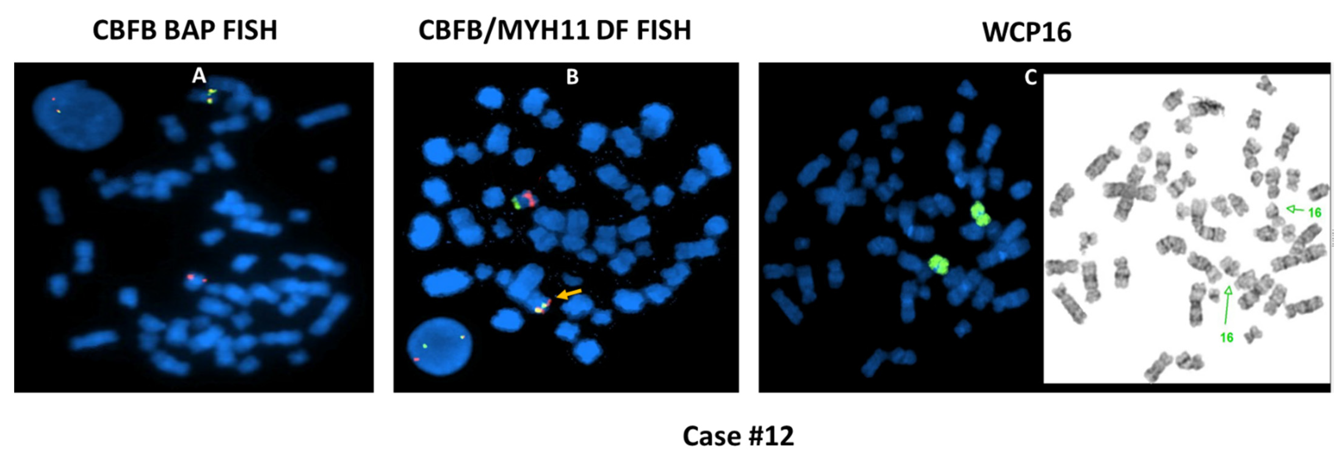 Cancers 13 05354 g004