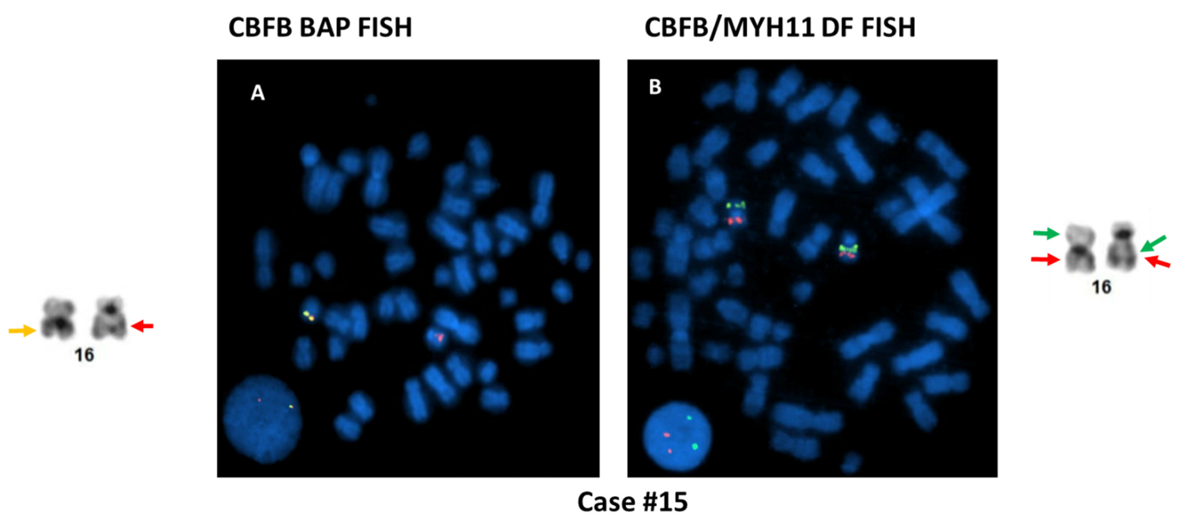 Cancers 13 05354 g005