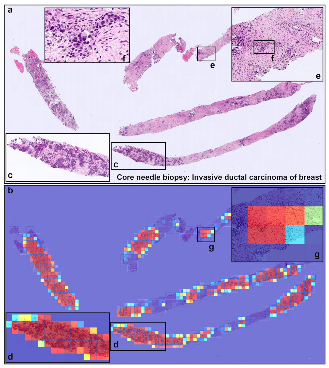 Cancers 13 05368 g004
