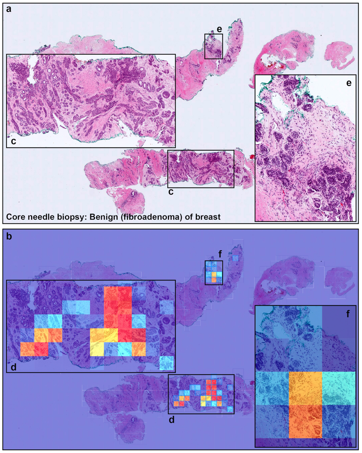 Cancers 13 05368 g005