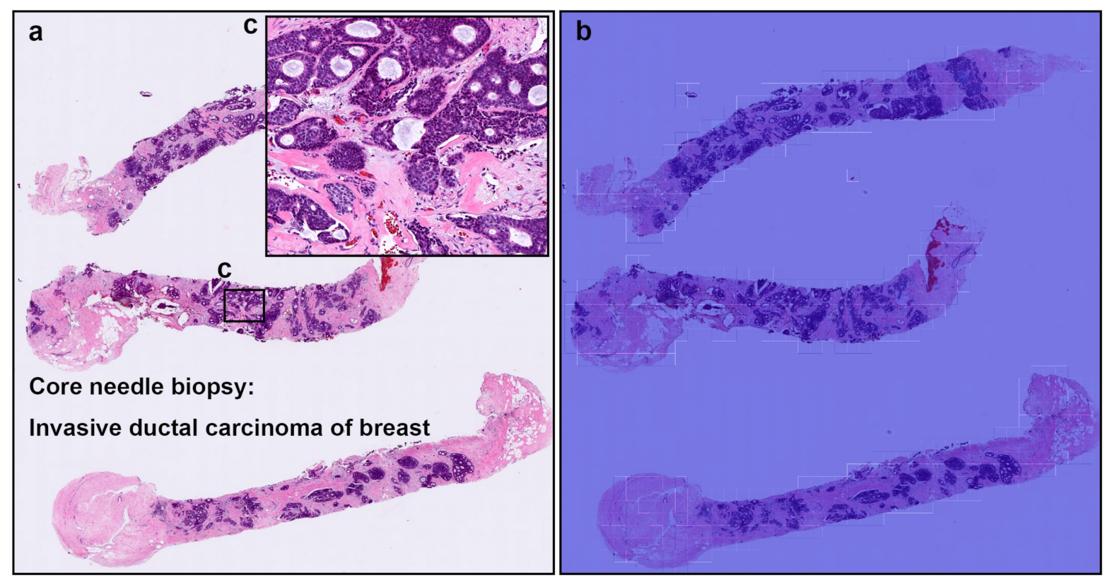 Cancers 13 05368 g006