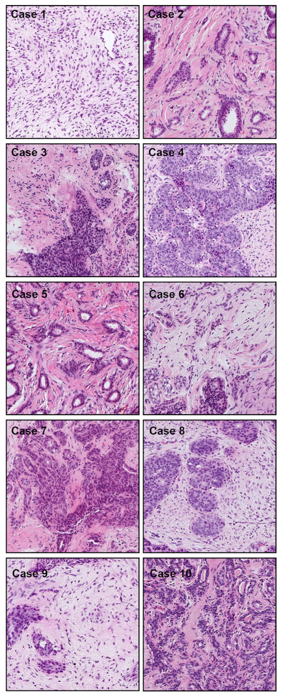 Cancers 13 05368 g008