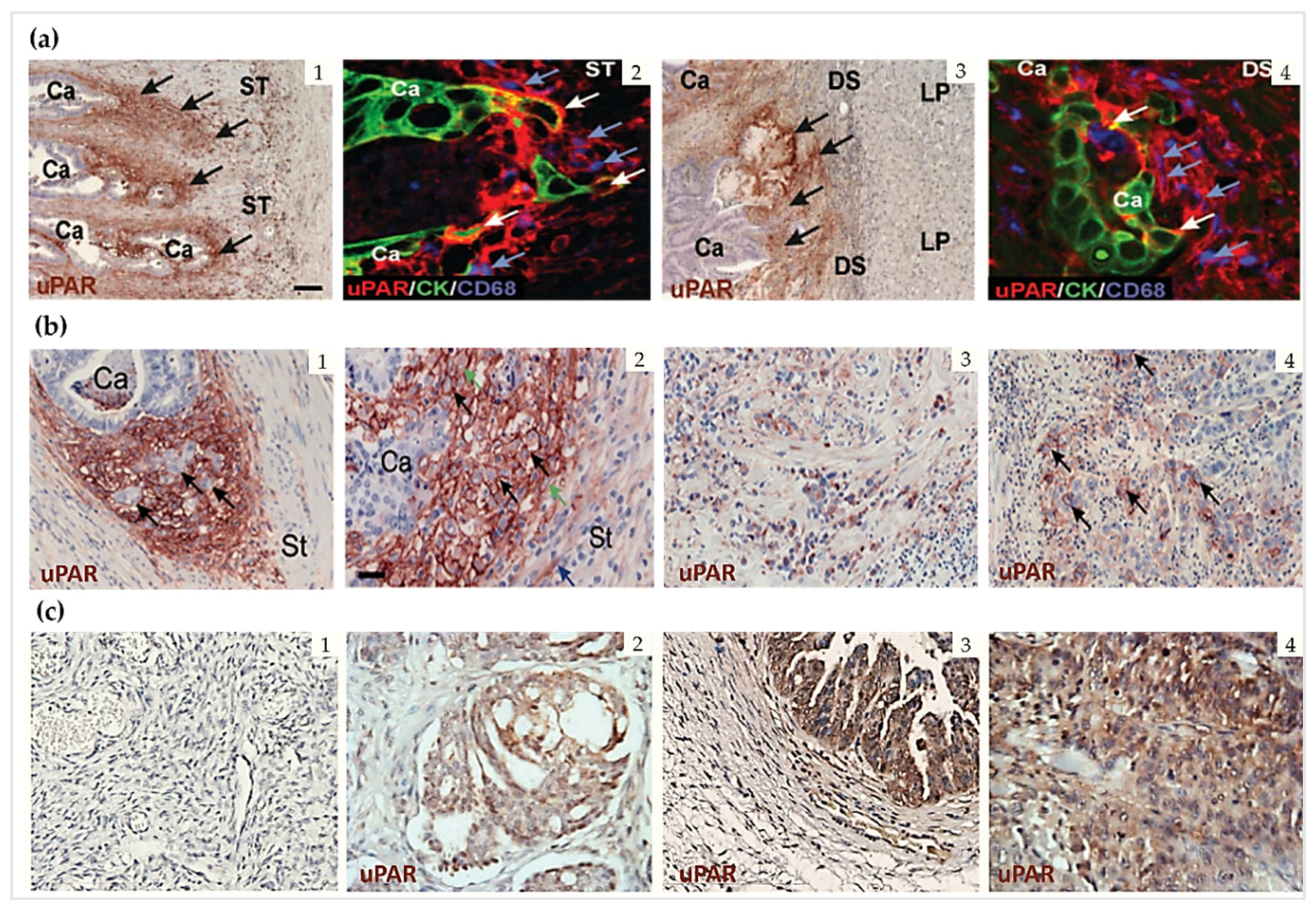 Cancers 13 05376 g005