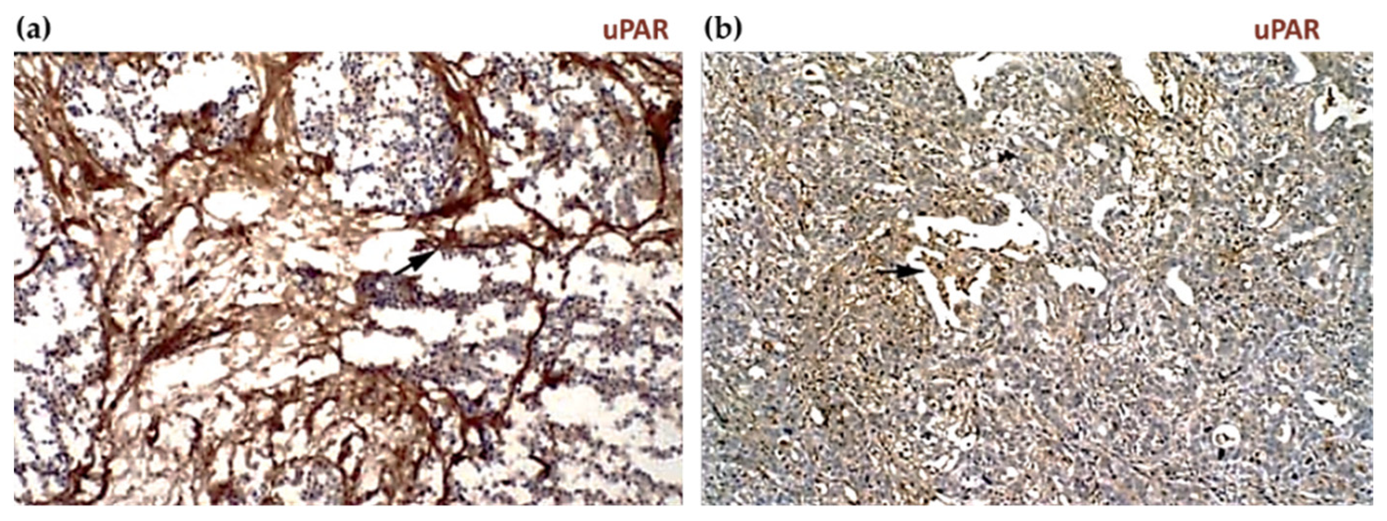 Cancers 13 05376 g006