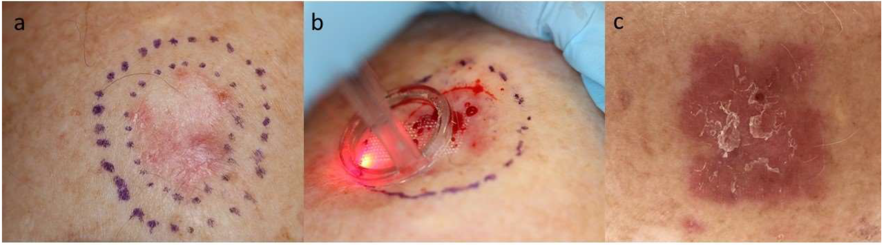 Cancers 13 05405 g001