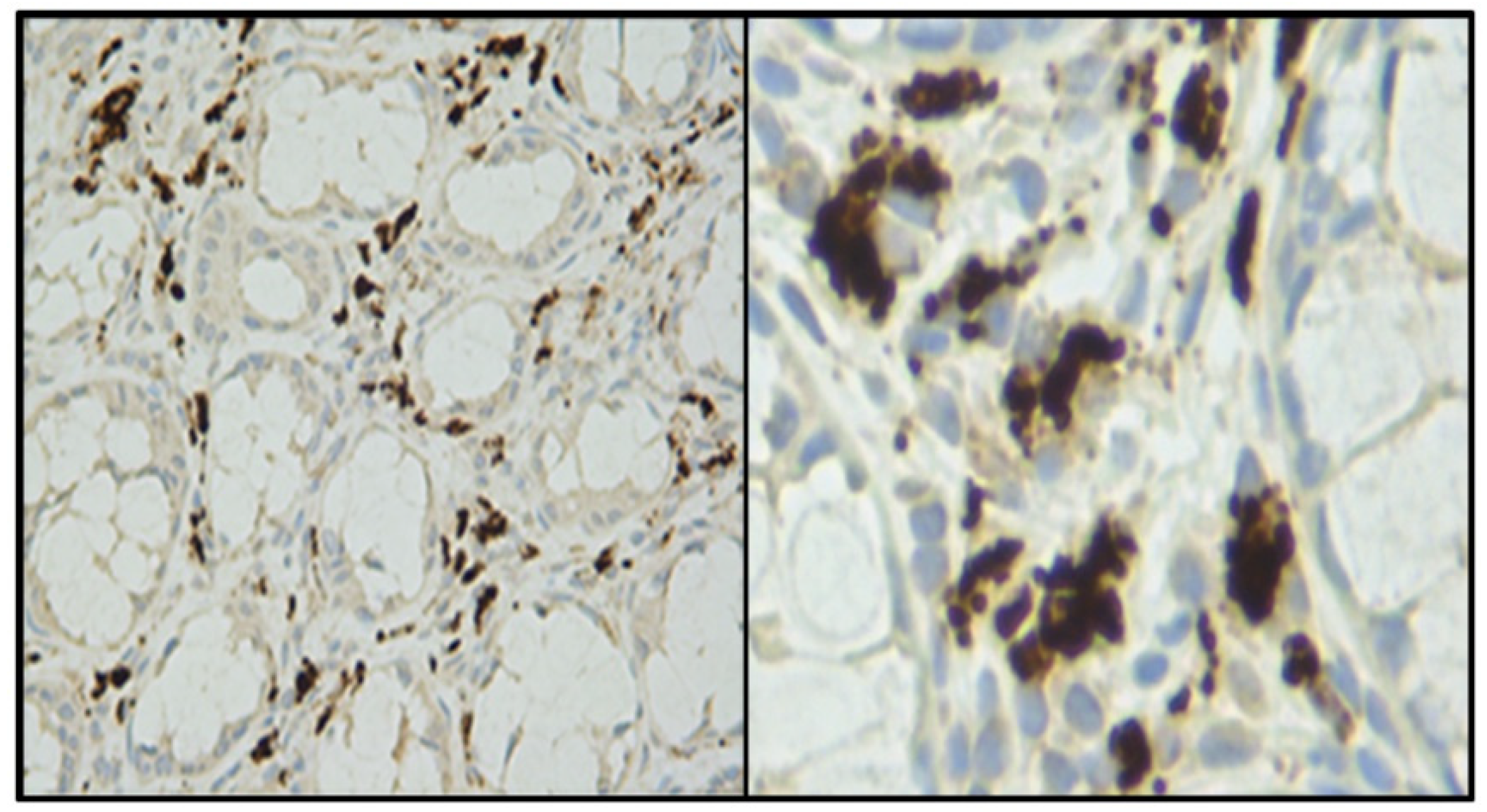 Cancers 13 05407 g003