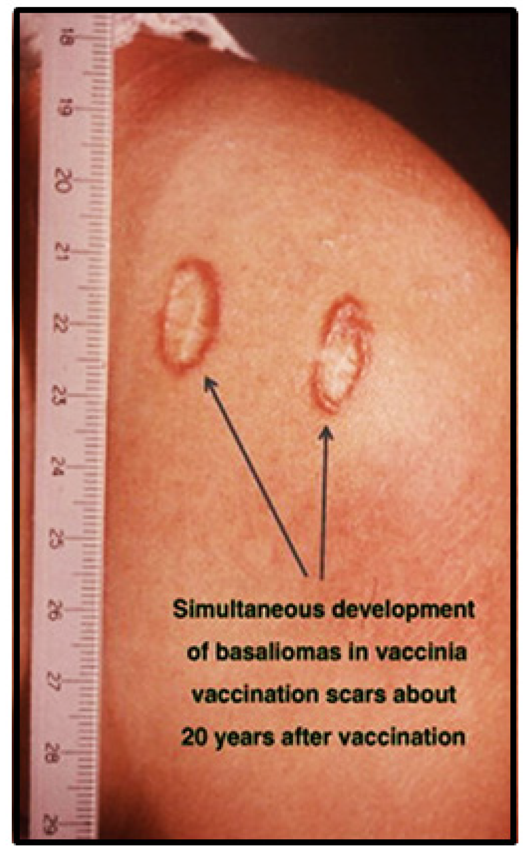 Cancers 13 05407 g012