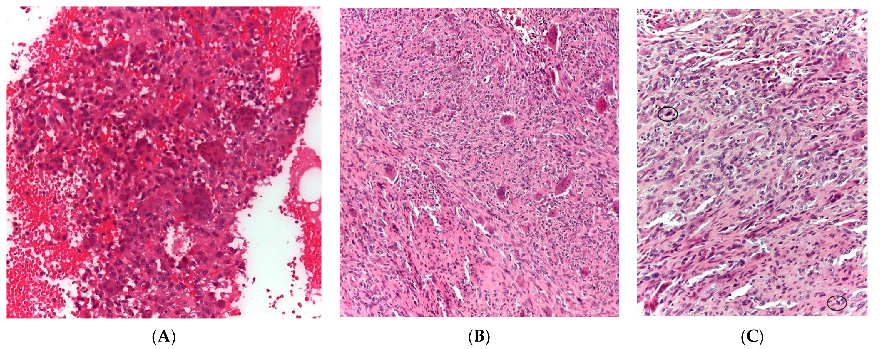 Cancers 13 05410 g001