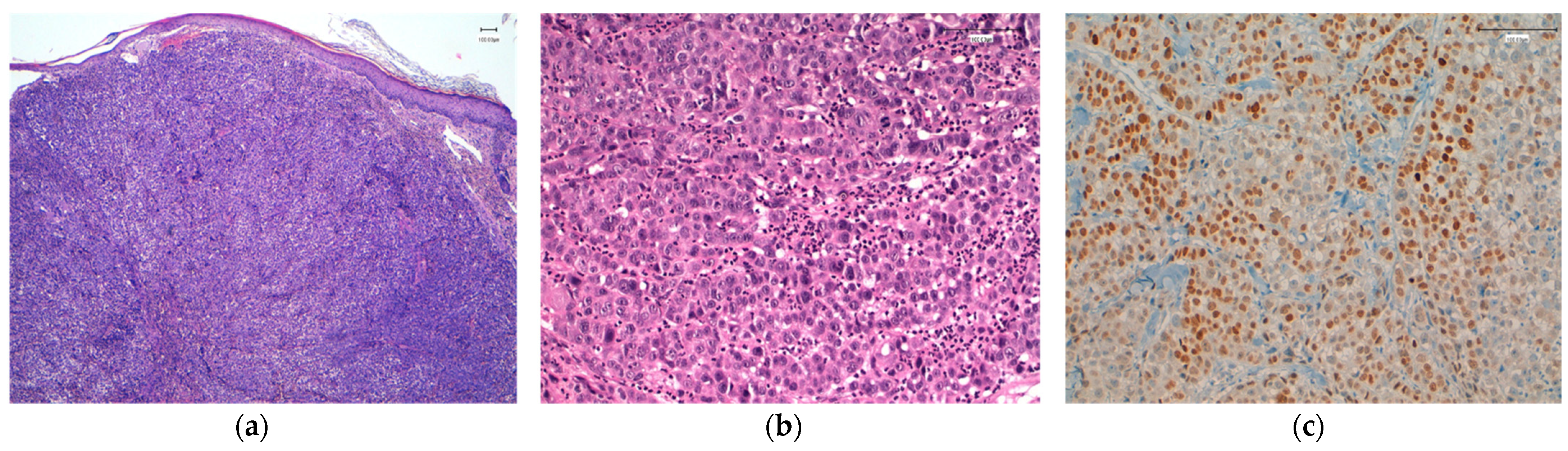 Cancers 13 05416 g005