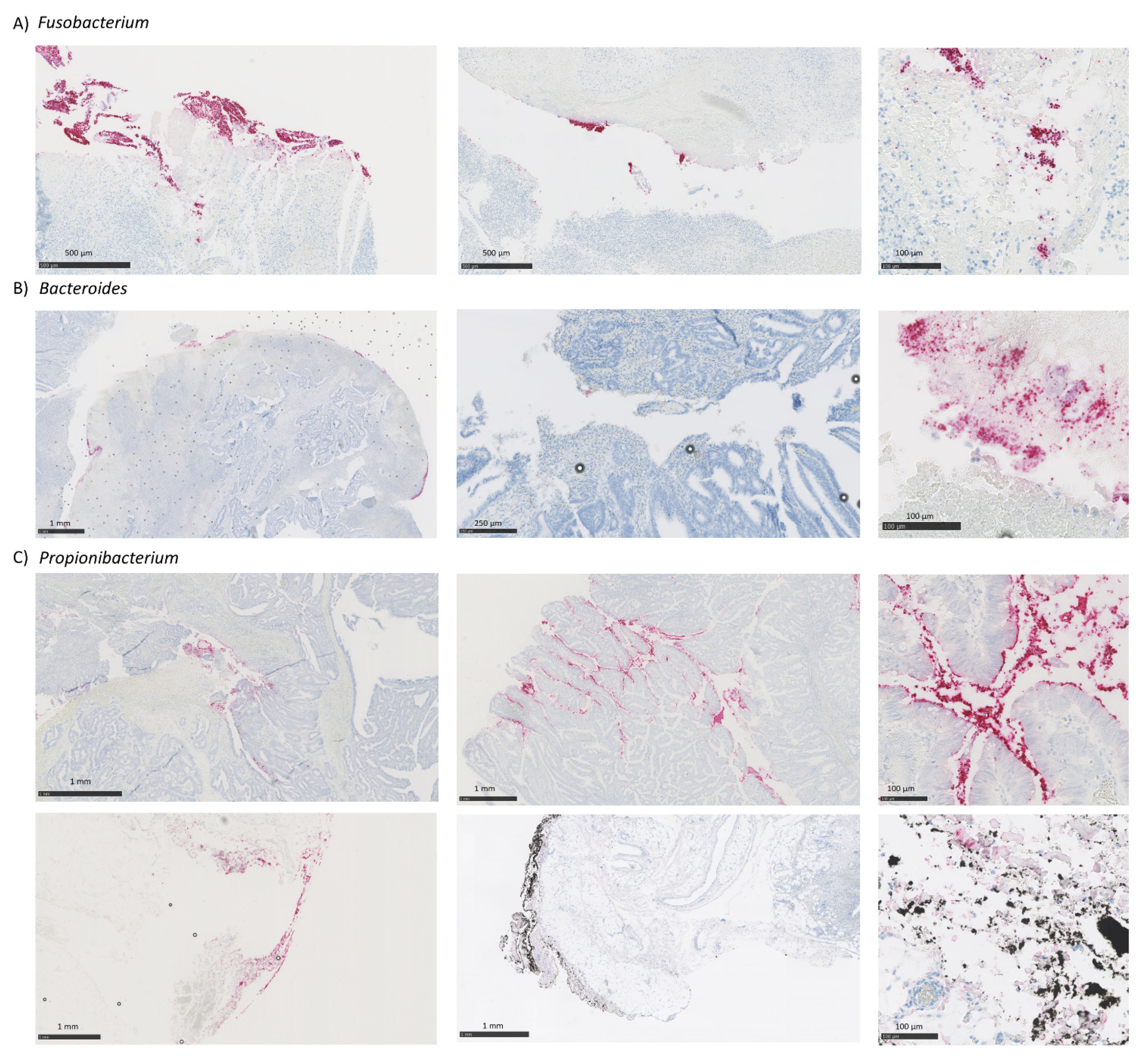 Cancers 13 05421 g004