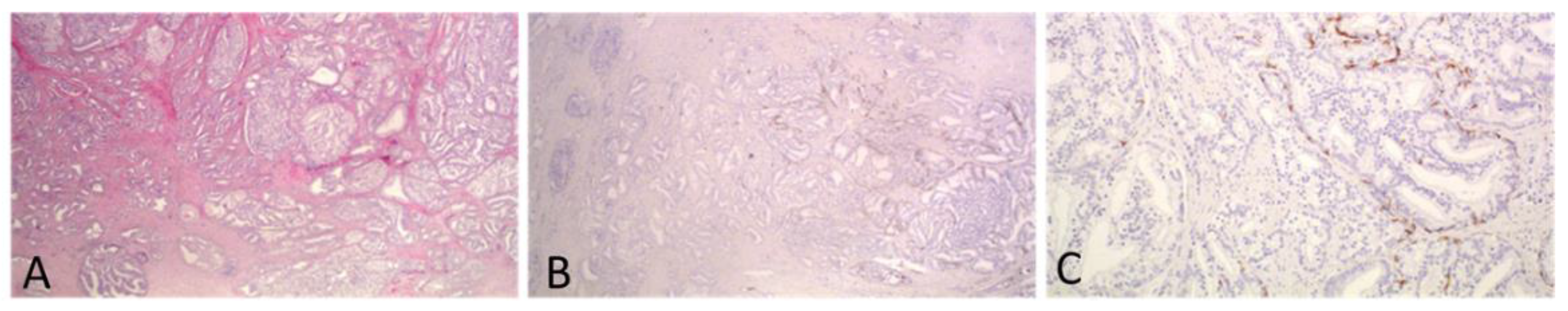 Cancers 13 05454 g003