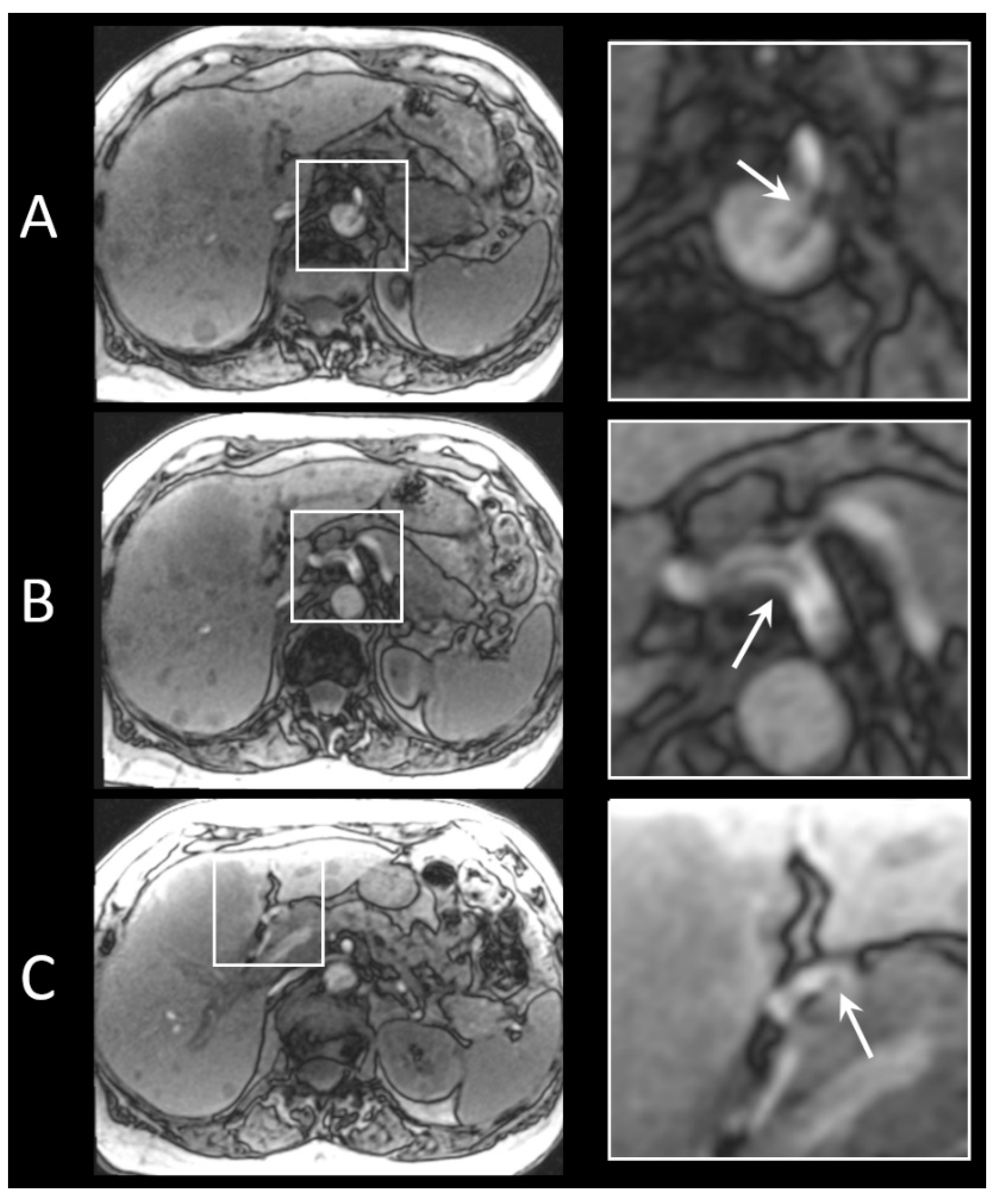 Cancers 13 05462 g005