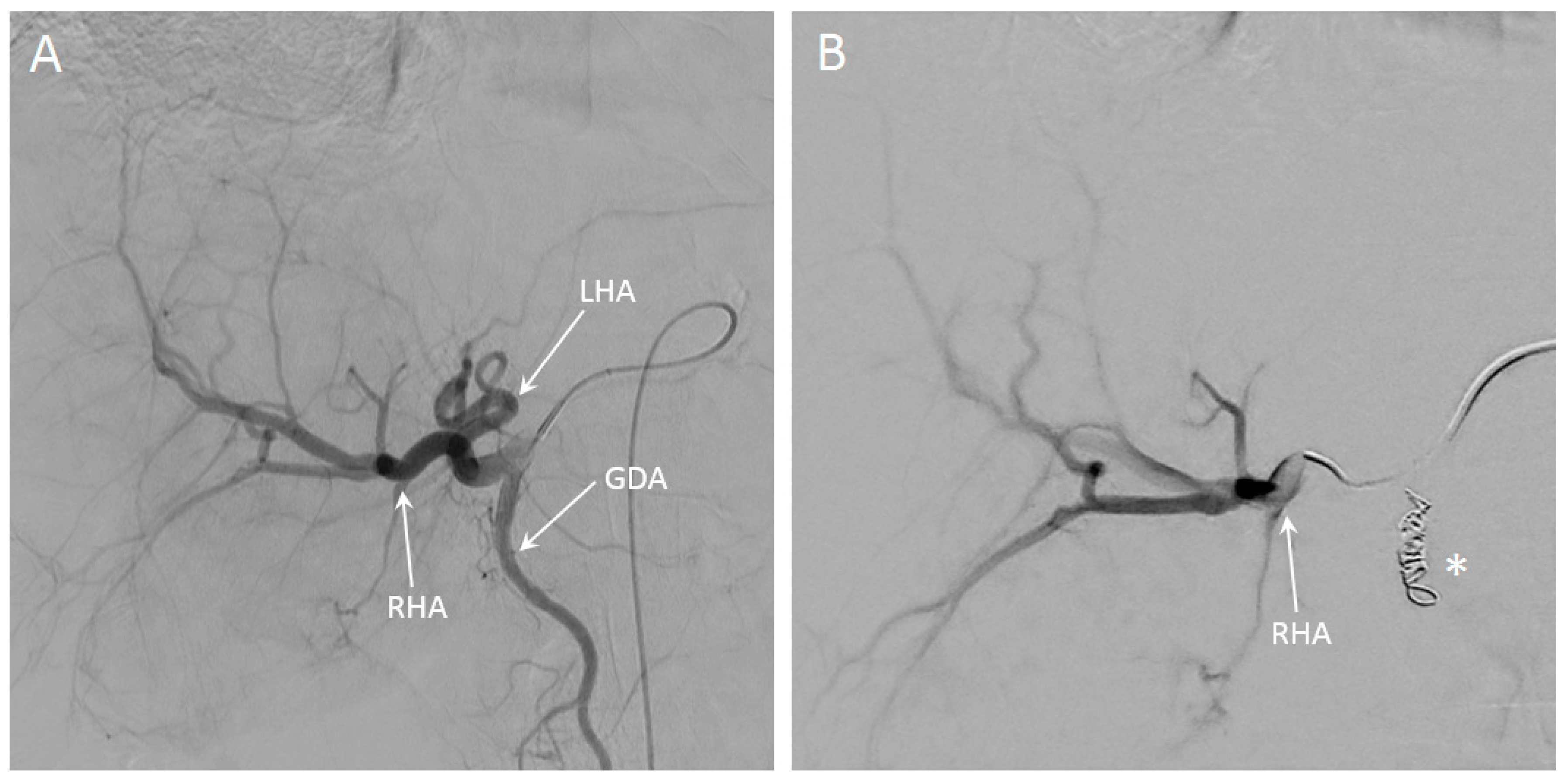Cancers 13 05462 g008