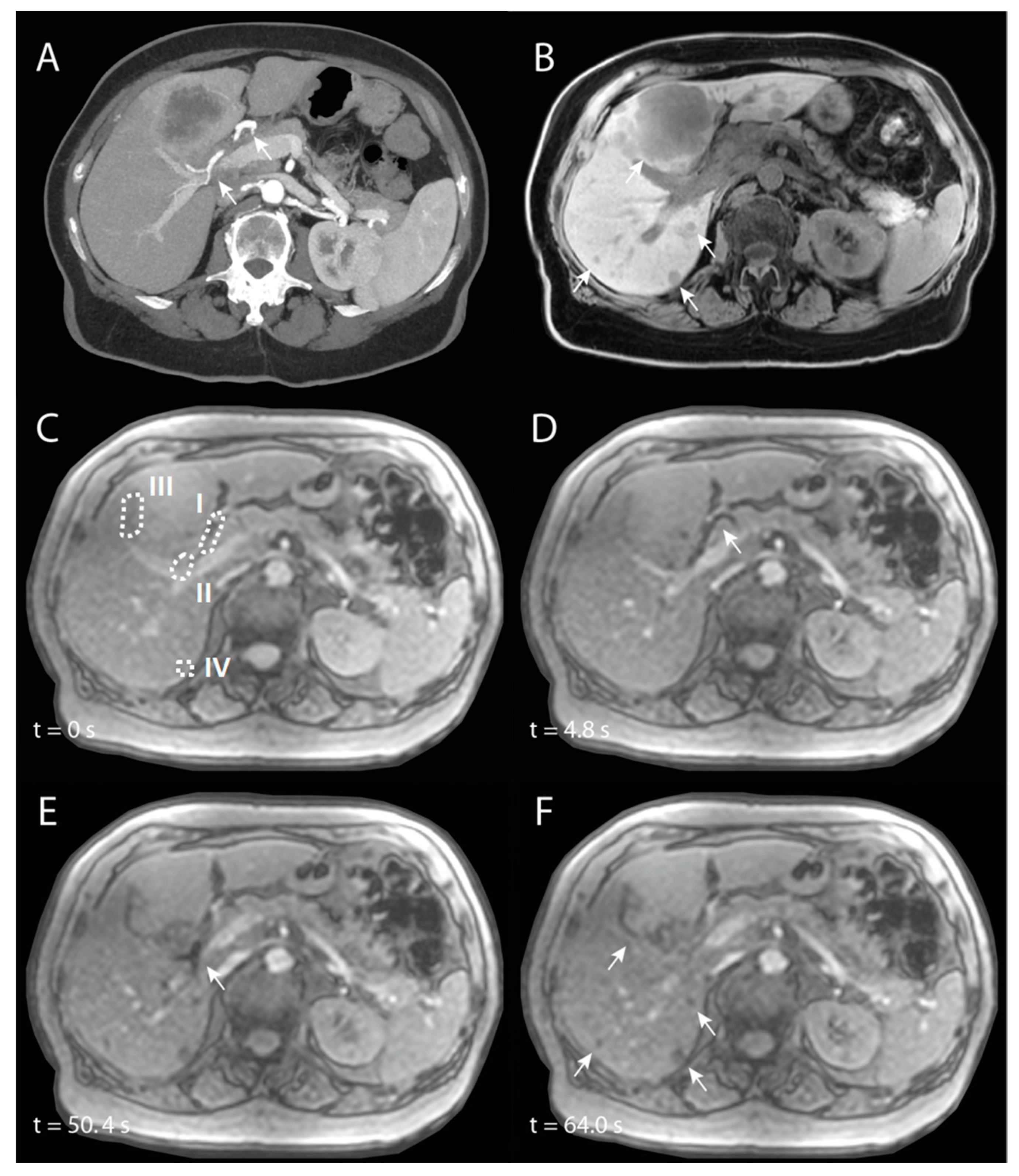 Cancers 13 05462 g009